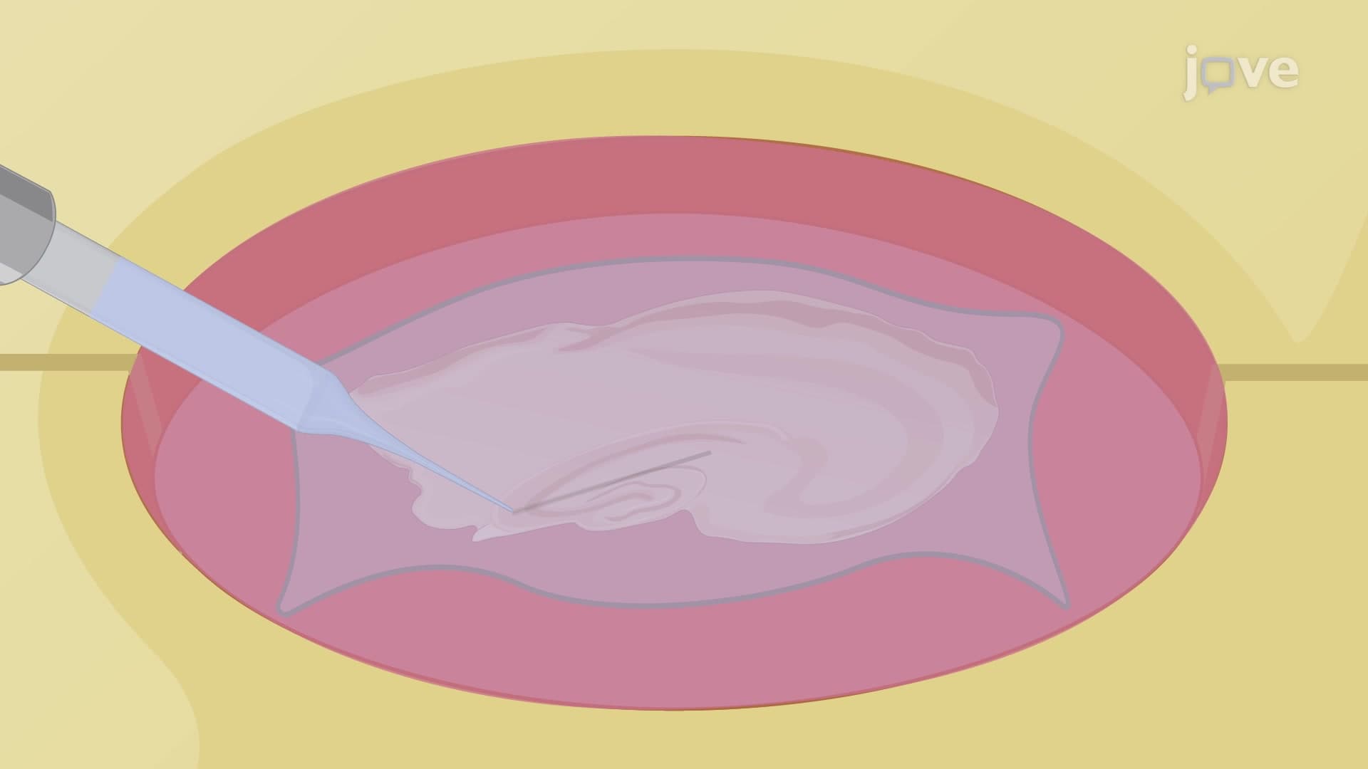 Electroencephalography-Based Recording Technique to Record the Epileptiform Activity
