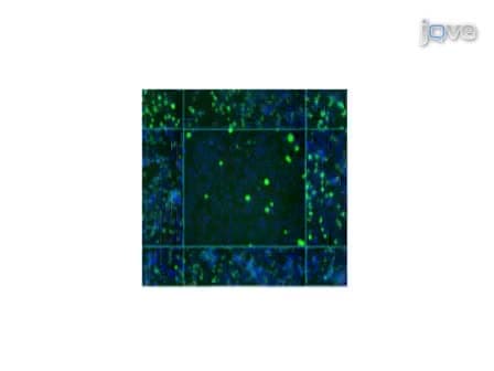 RNAi Screening for Host Factors Involved in <em>Vaccinia</em> Virus Infection using <em>Drosophila</em> Cells