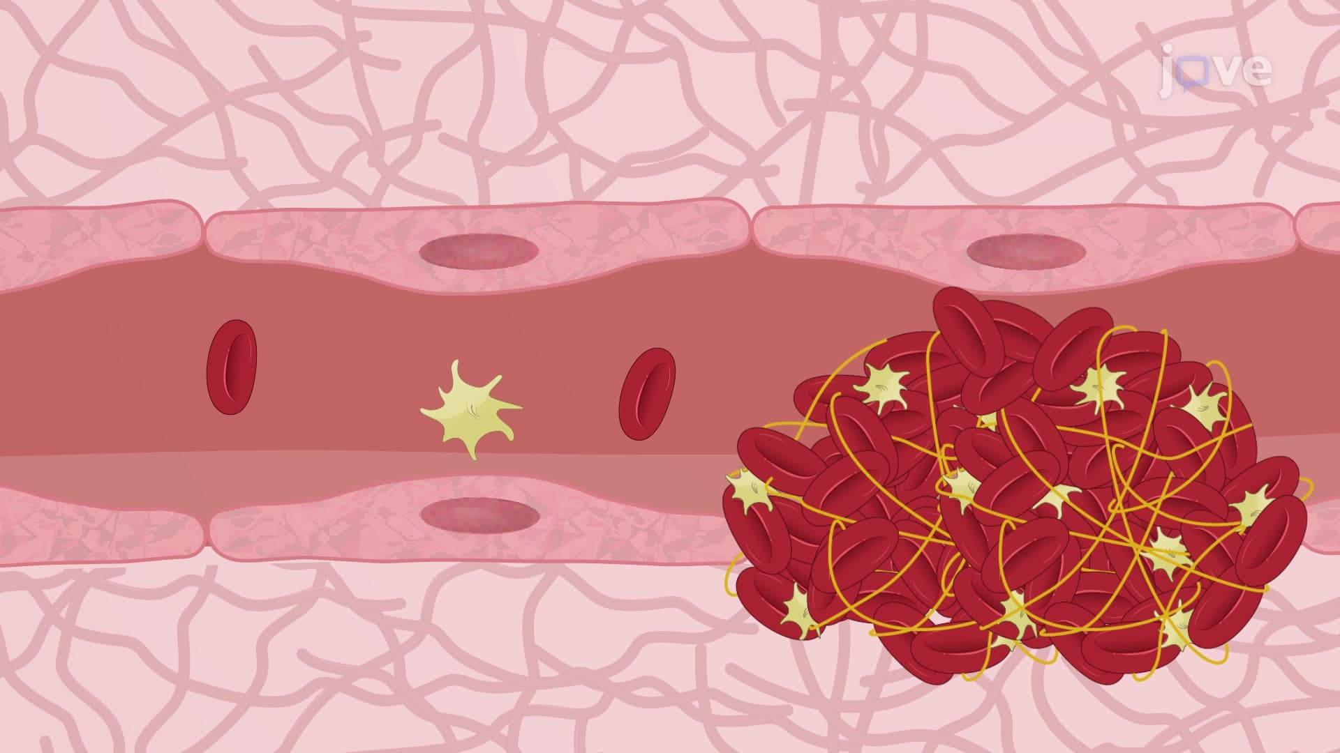 Intravital Fluorescence Microscopy to Study Microvascular Thrombus Formation