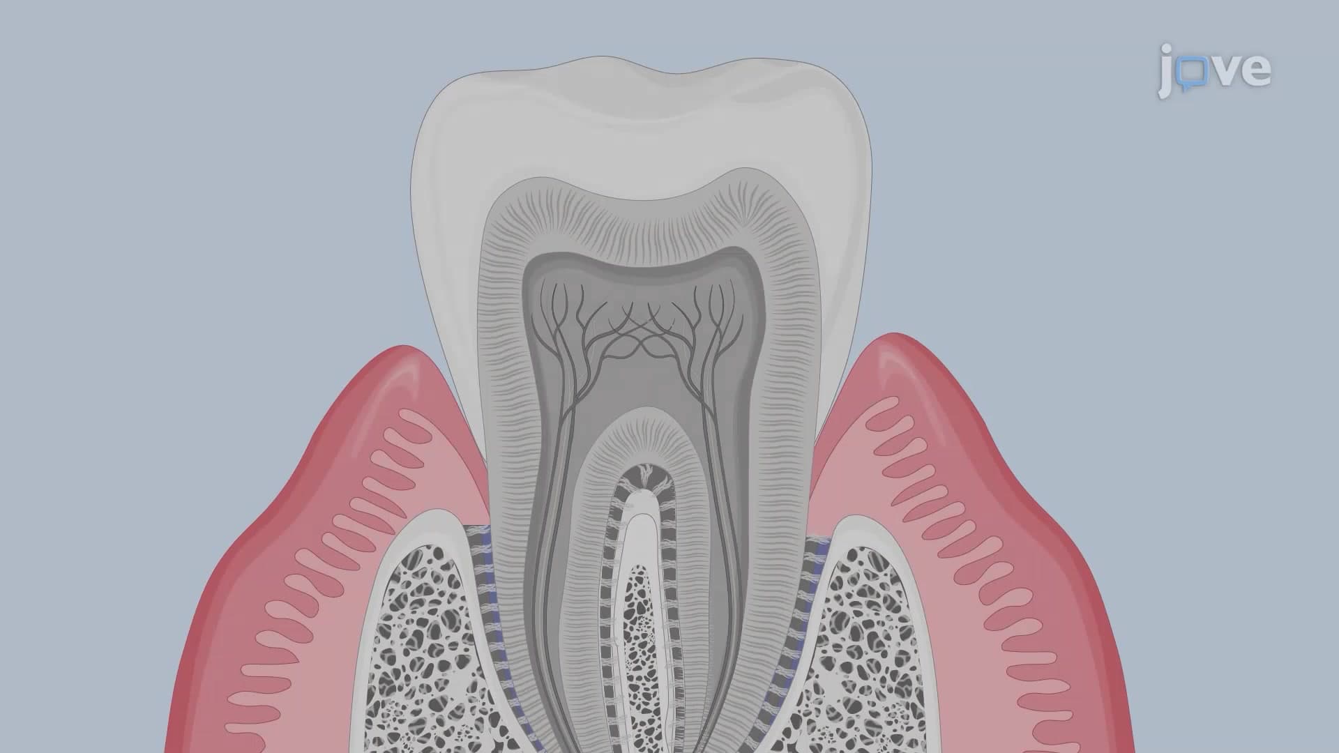 Isolation of Gingival Immune Cell Network from Murine Teeth Blocks