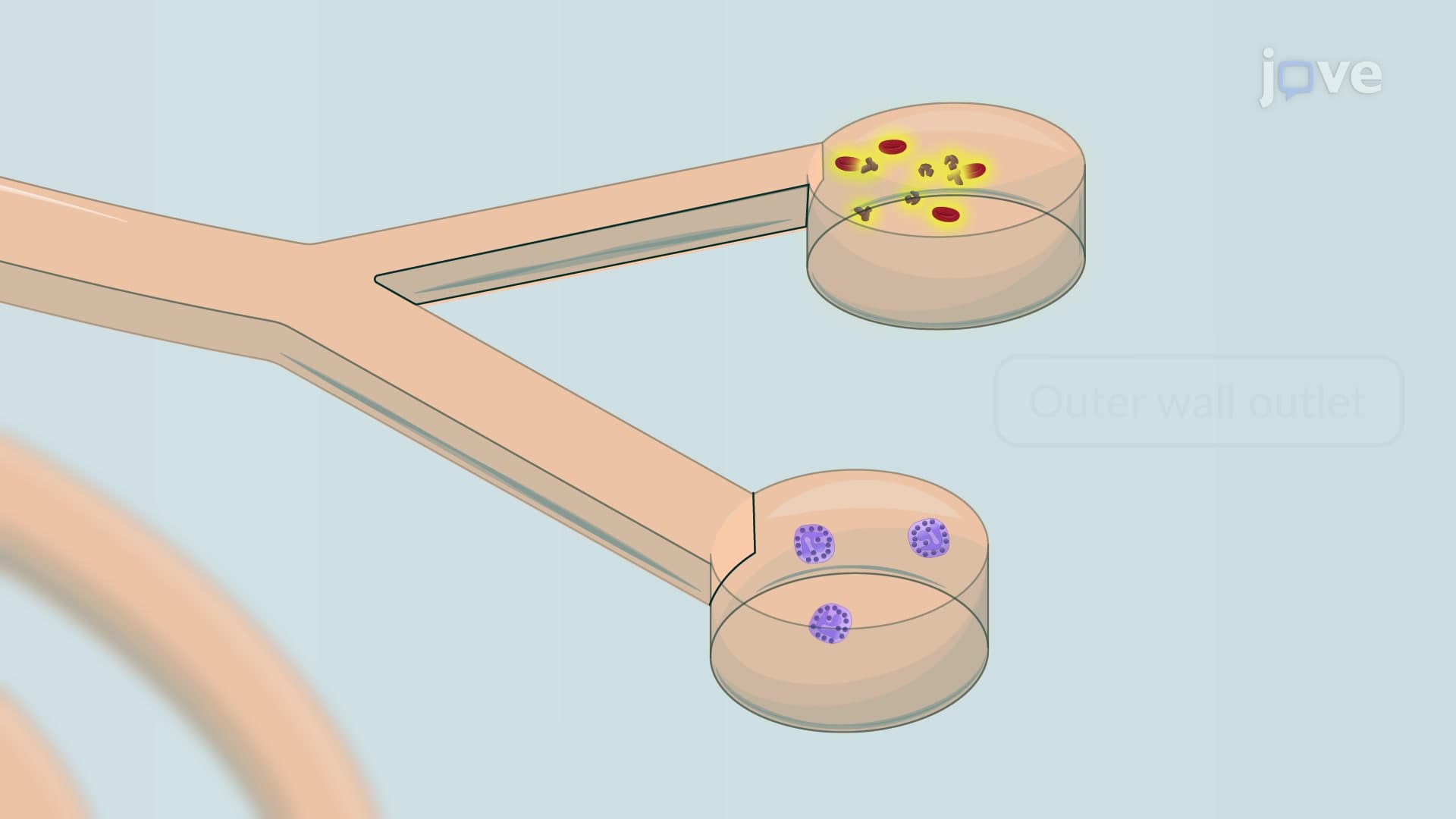 Label-Free Neutrophil Separation from Tracheal Secretion Using Spiral Microfluidics Channel