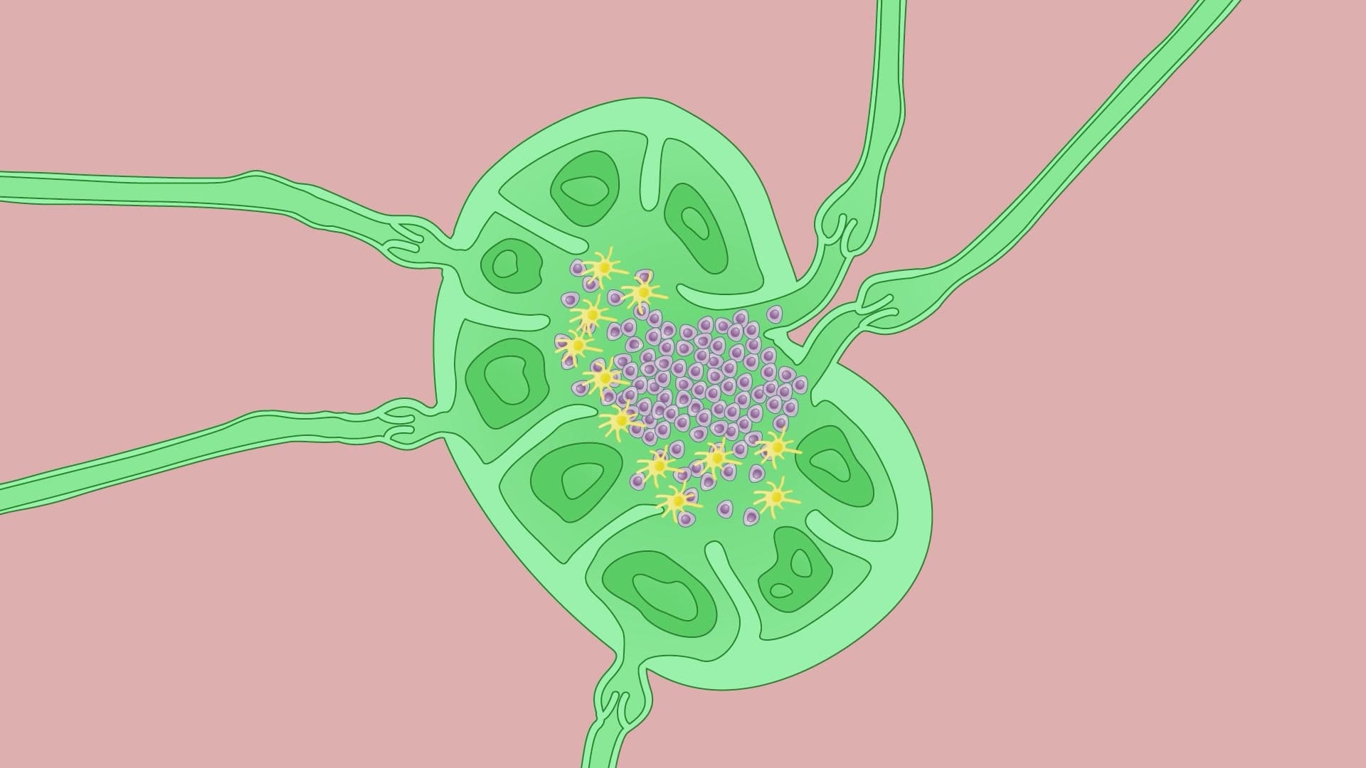 Harvesting an Inguinal Draining Lymph Node from a Murine Model