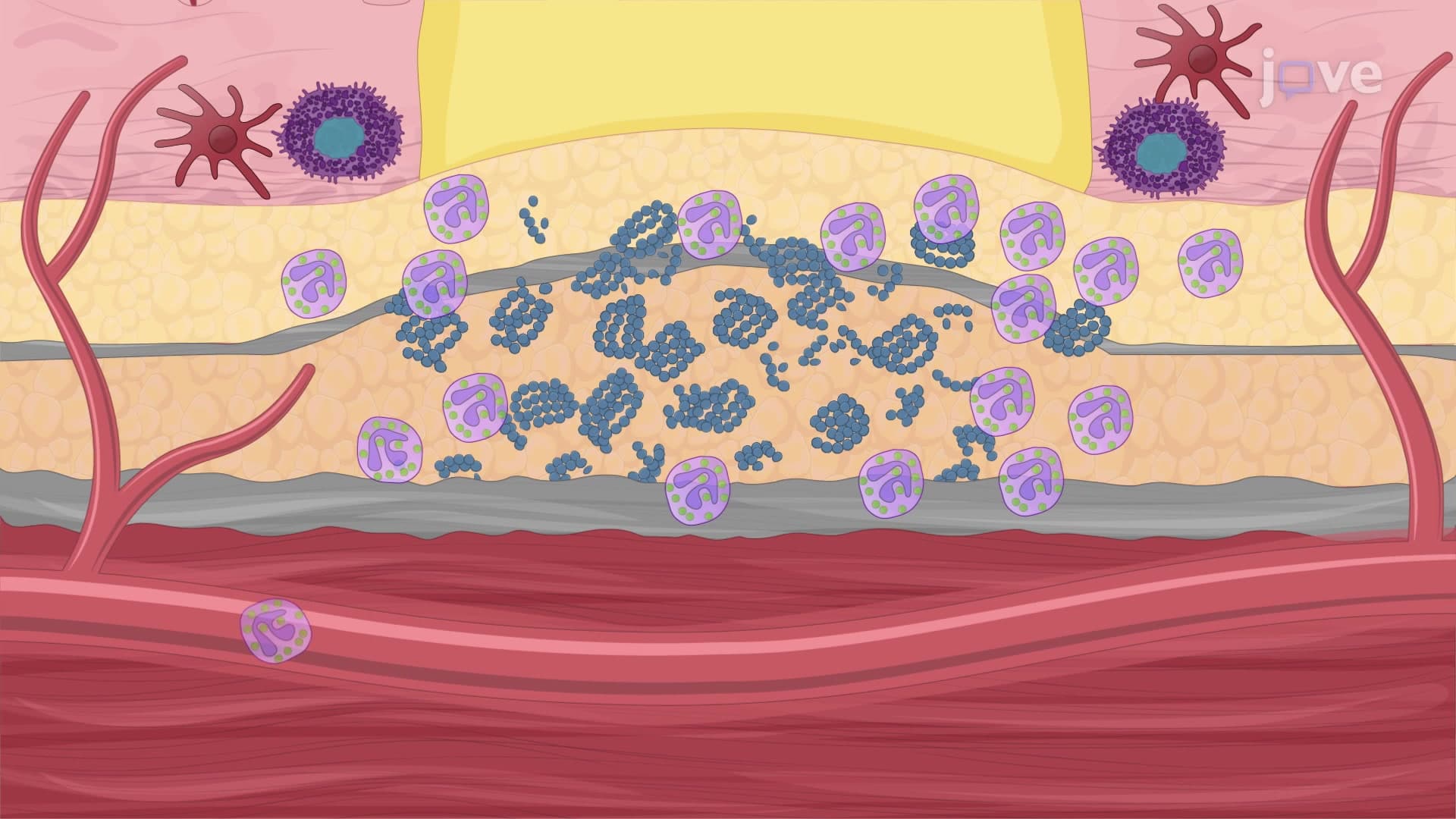Monitoring Neutrophil Recruitment Dynamics and Bacterial Burden at the Infection Site in a Murine Model