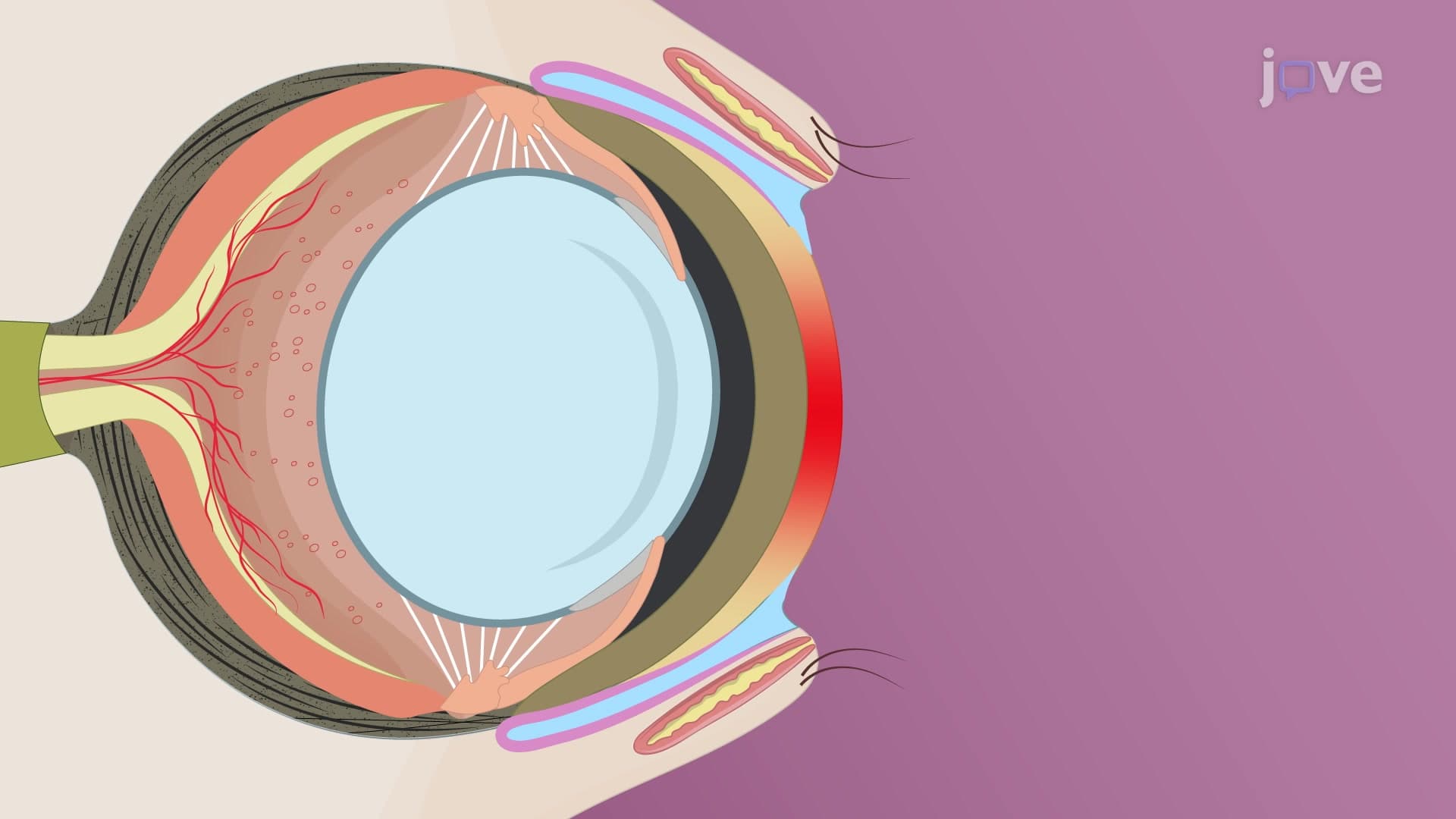 A Method to Induce Ocular Surface Inflammation in a Murine Model