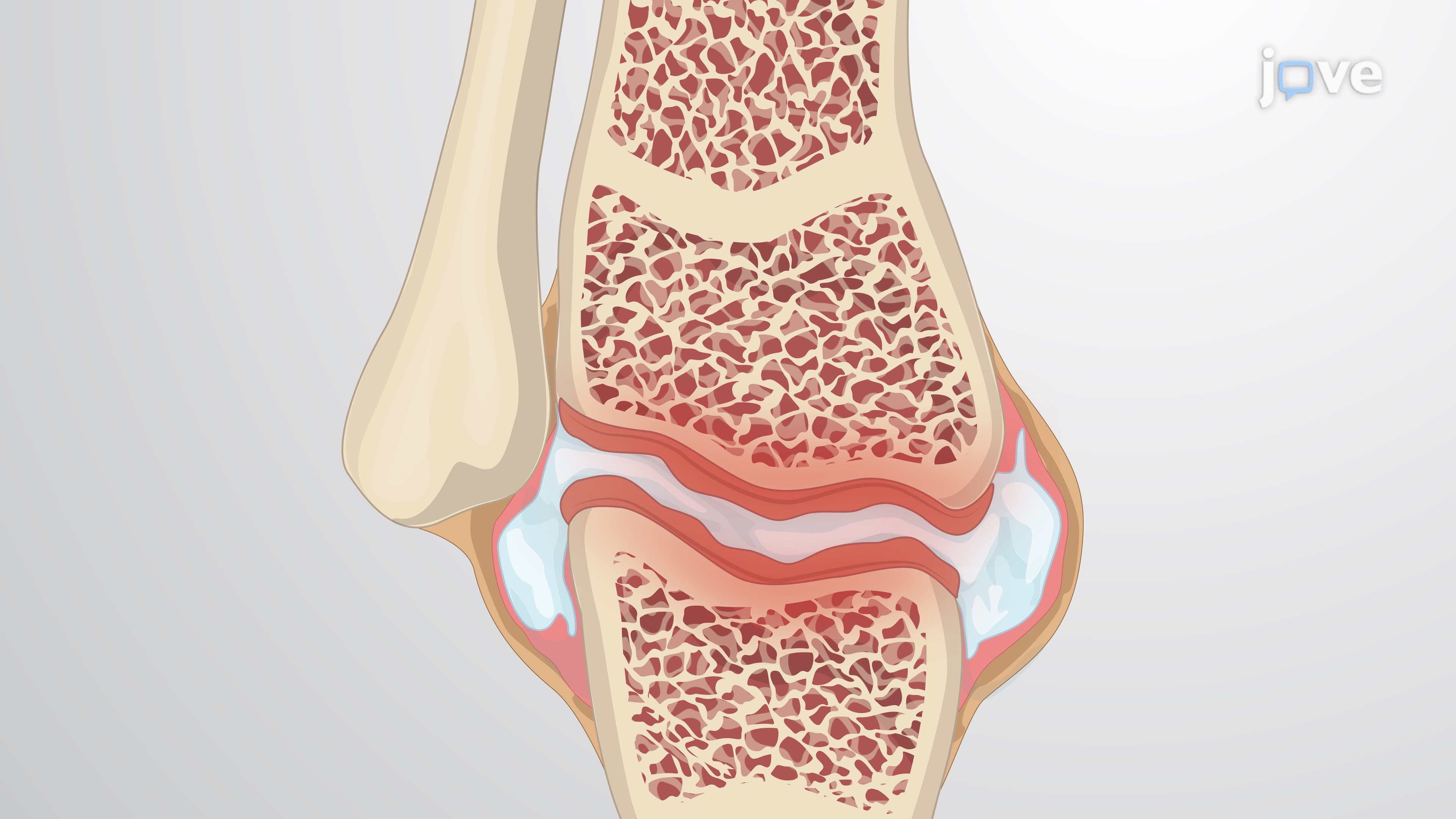 A Technique to Generate an Adjuvant-Induced Arthritis Mouse Model