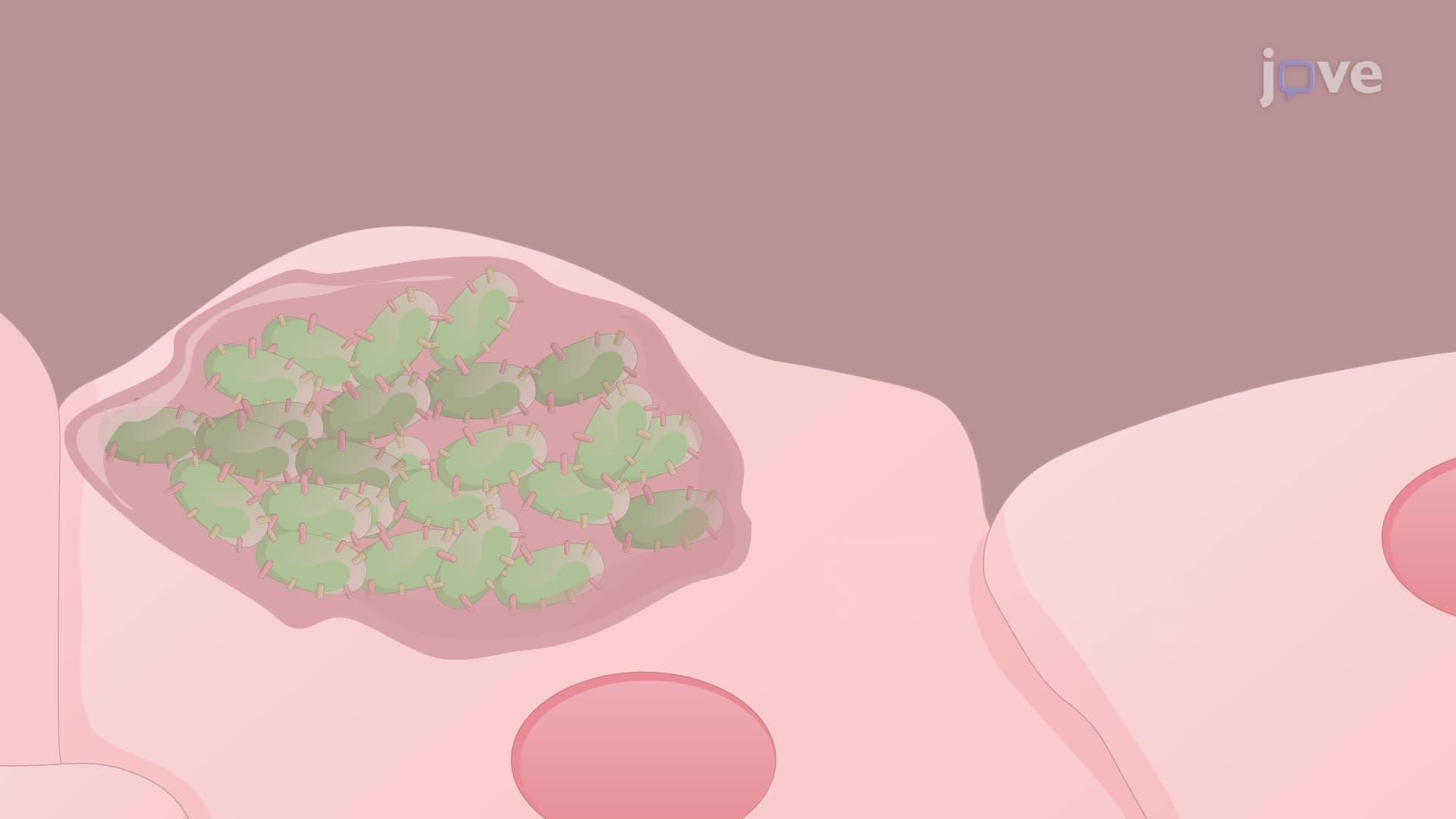 Establishment of a Urinary Tract Infection Model in Female Mice