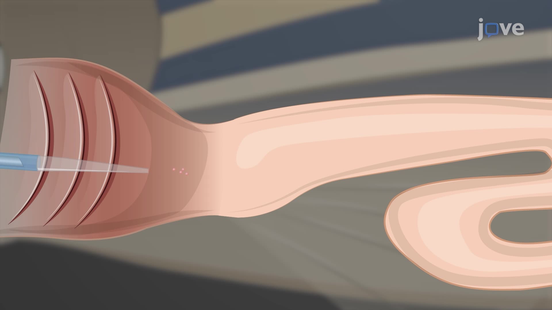 Oral Intubation of Adult Zebrafish to Administer Experimental Compounds