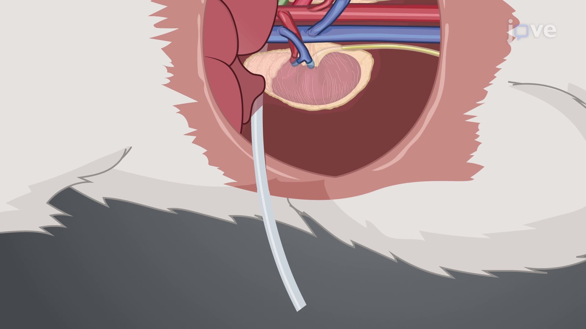 Mesenteric Lymph Duct Cannulation in a Rat Model to Harvest Lymph Fluid
