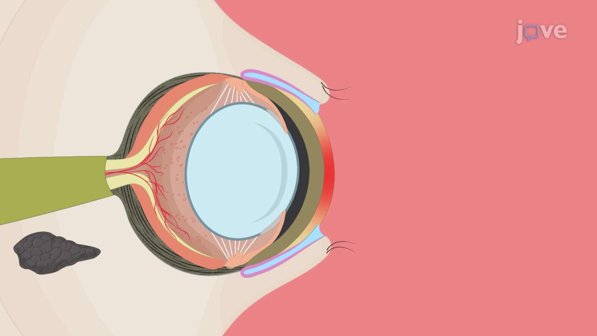 A Technique to Induce Chronic Experimental Autoimmune Dry Eye in Rats