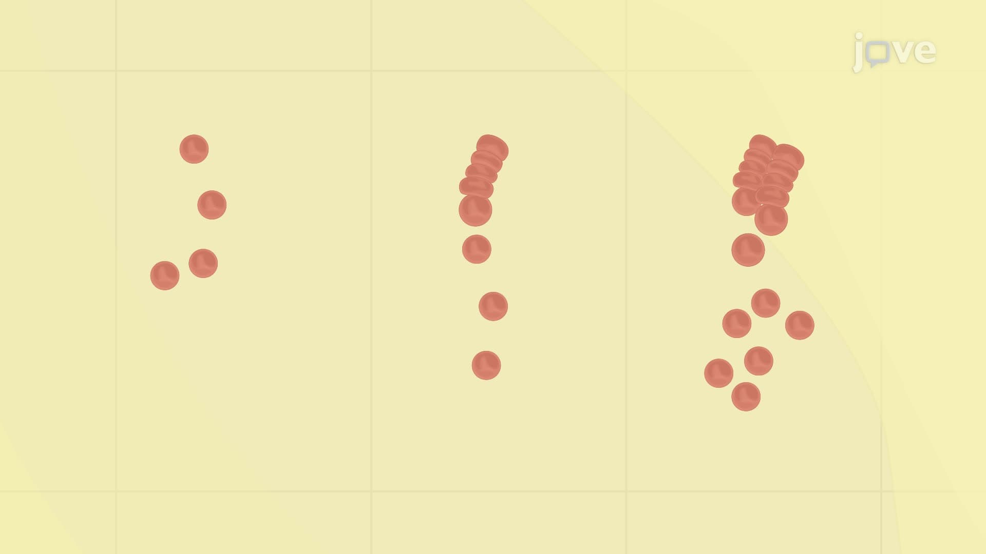 A Serum Bactericidal Assay for the Complement-Mediated Bactericidal Activity of Antibodies