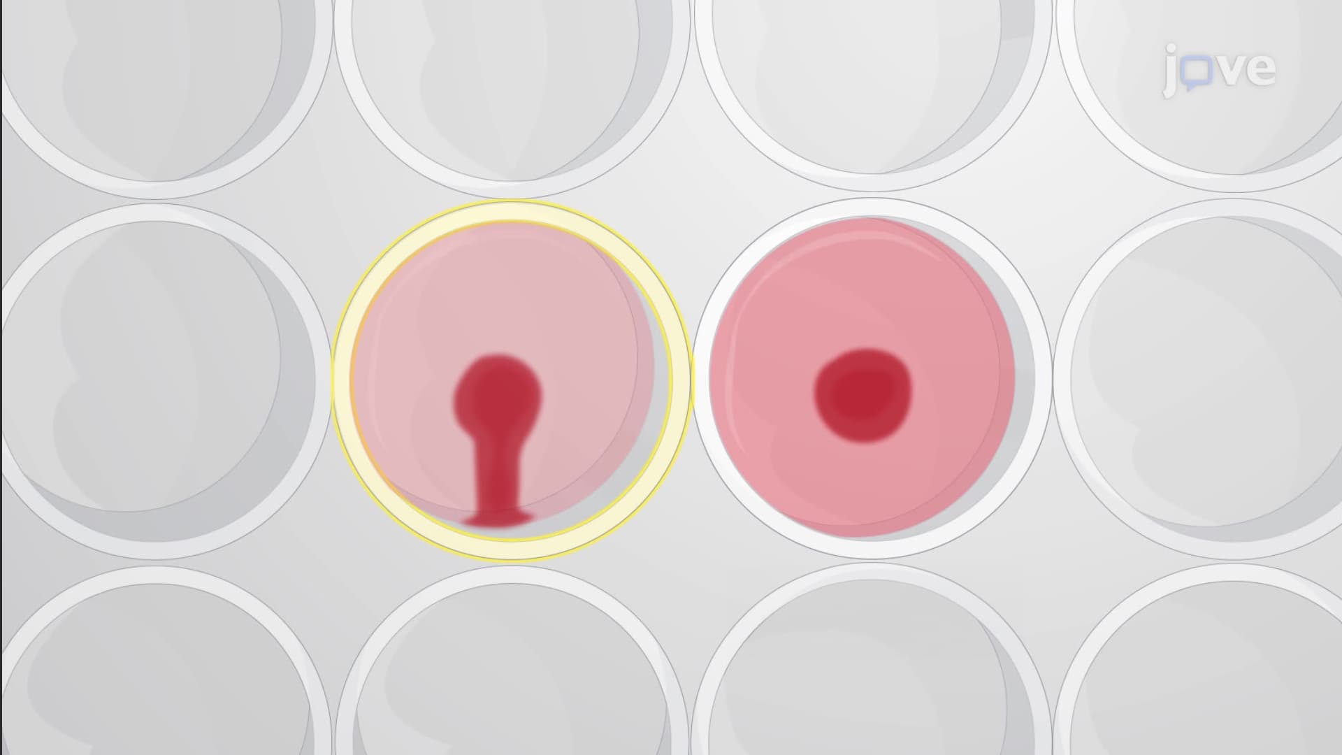 The Hemagglutination Inhibition Assay to Detect Serum Antibodies Against a Target Antigen