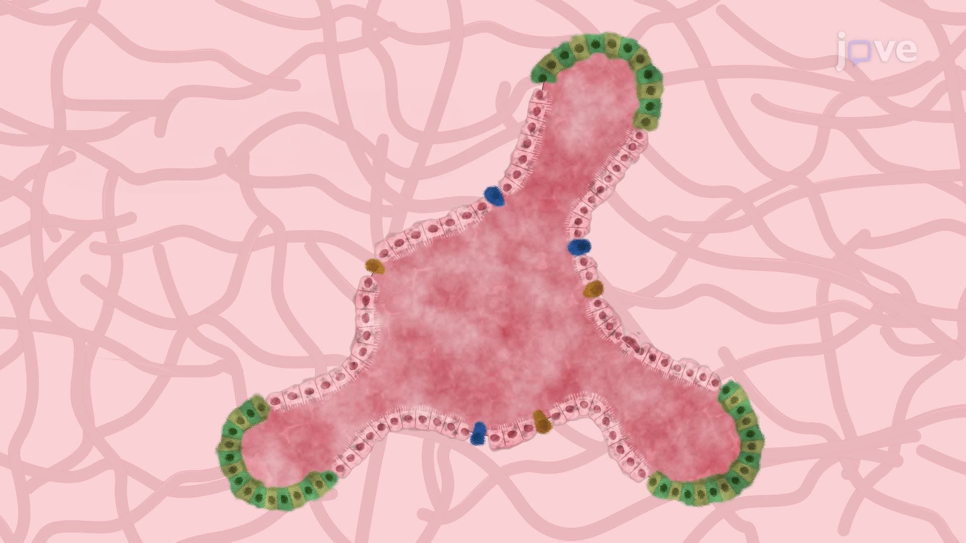 Induction of Necrotizing Enterocolitis in Human Epithelial Enteroid Model