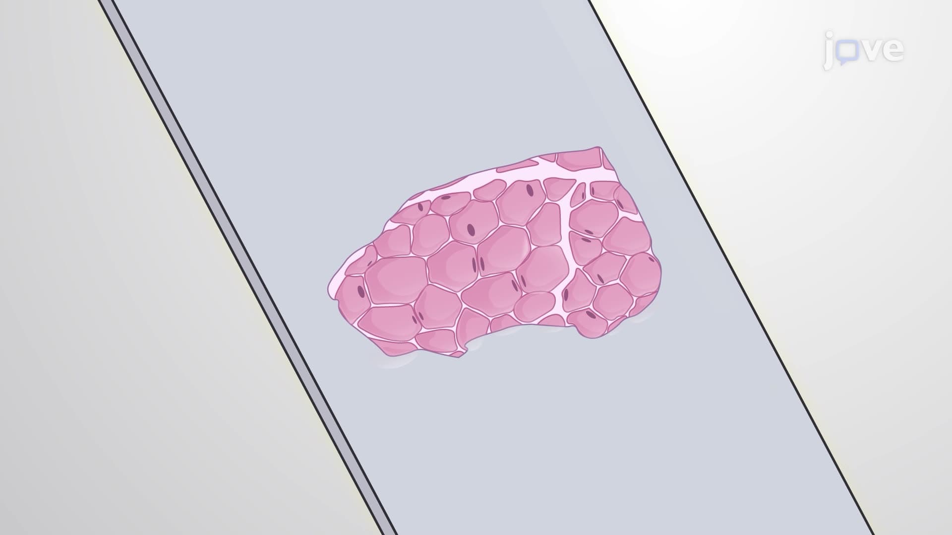 Visualization of Bacteria in Bladder Biopsy Sections via Fluorescence In Situ Hybridization