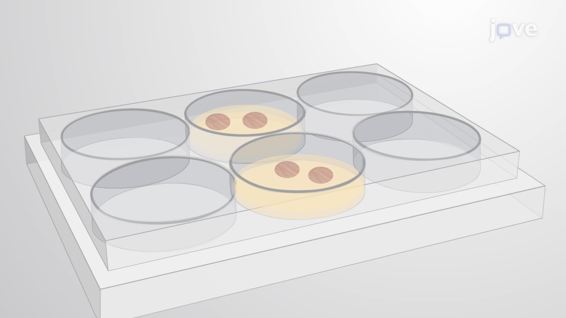 Agarose-Based Preparation of Human Precision-Cut Lung Slices