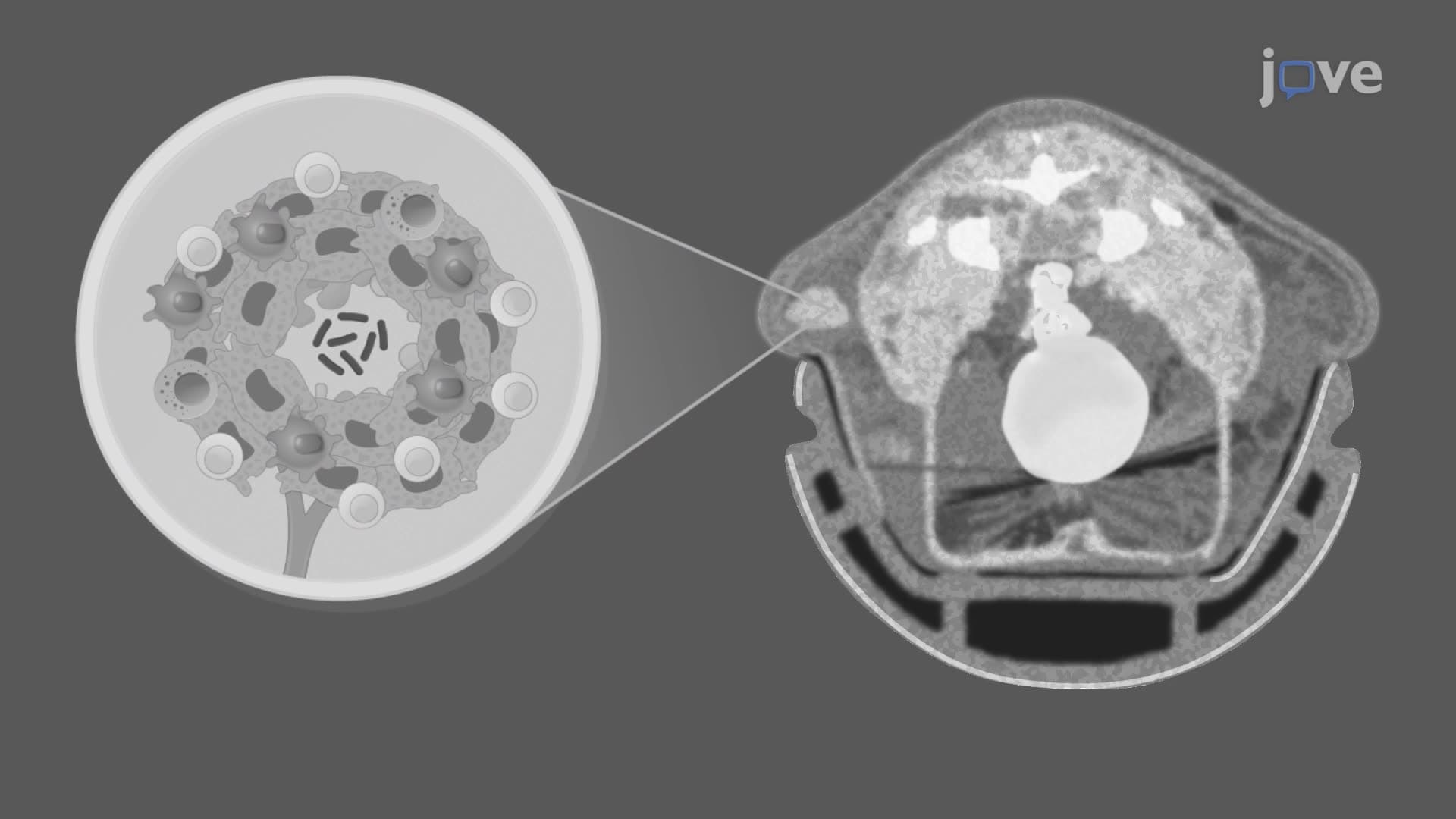 A Technique to Detect Extrapulmonary Tuberculosis via Superparamagnetic Nanoprobes