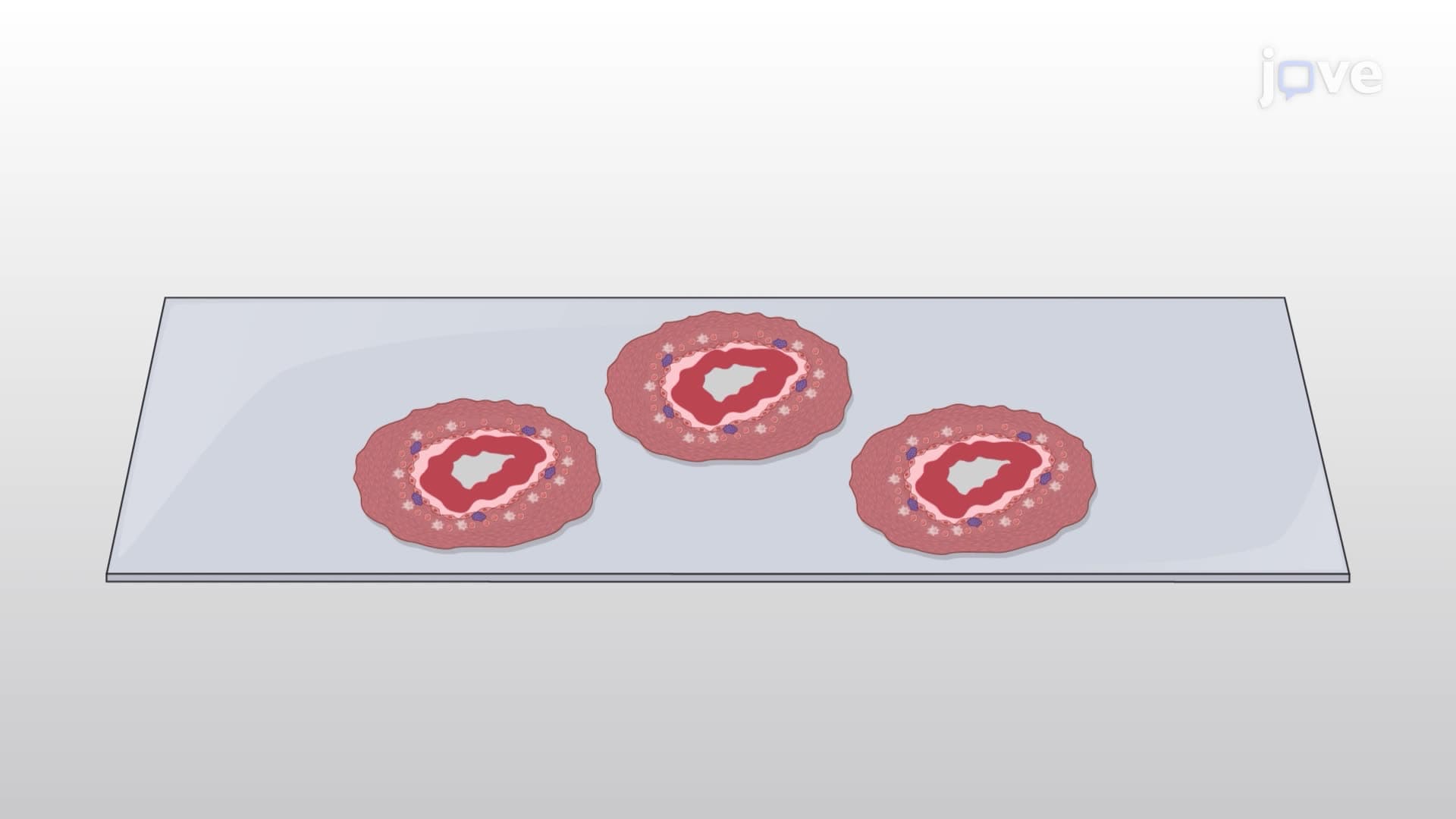 Immunohistochemistry to Study the Relationship Between Macrophages and Infiltrated Immune Cells