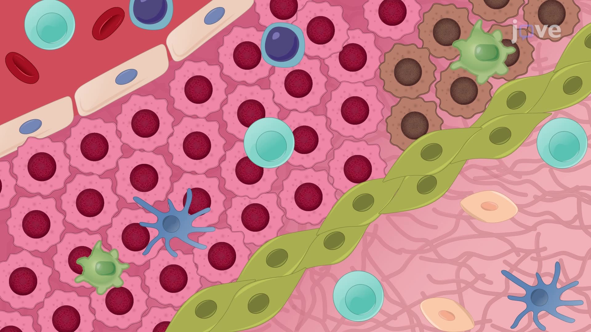 Real-Time Analysis of Resident T-cell Migration in Different Tumor Regions Using Confocal Microscopy