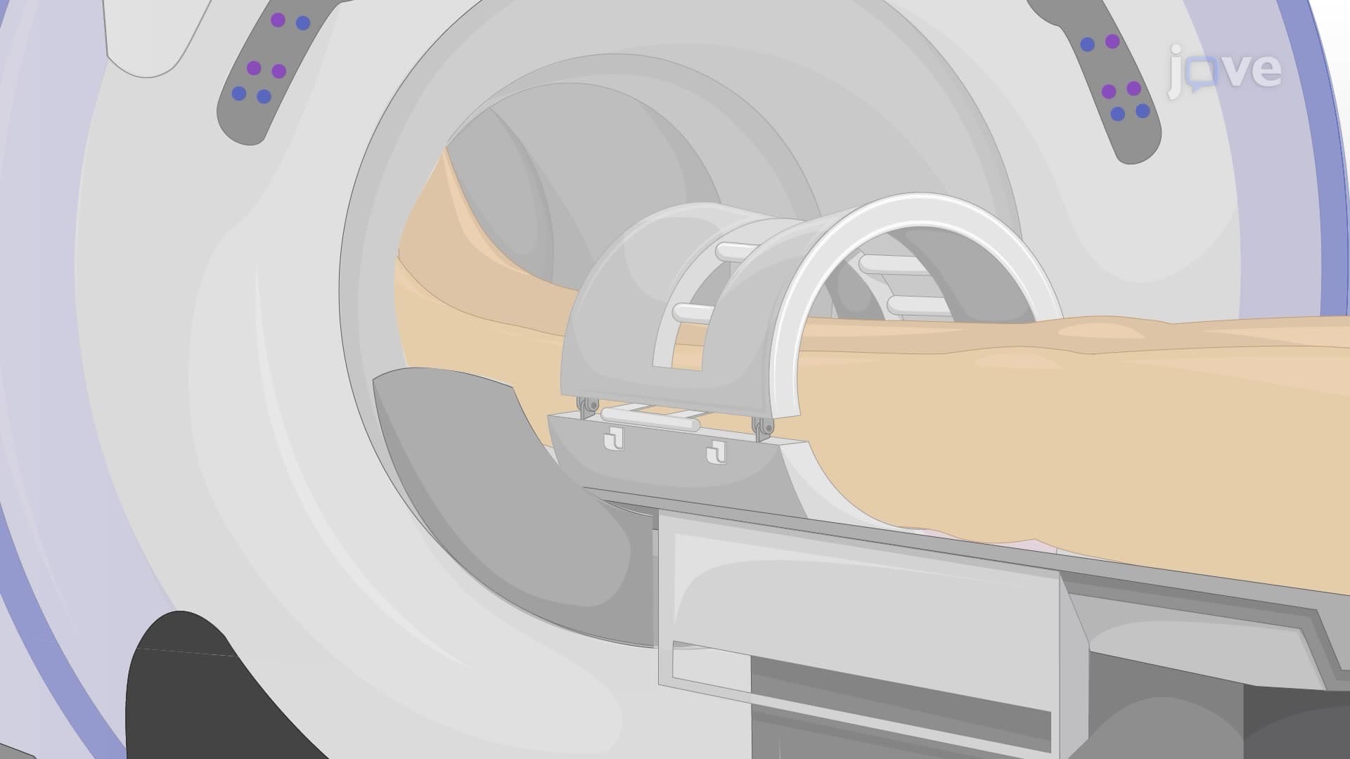 Using 23Na Magnetic Resonance Imaging to Measure Sodium in Muscle Tissues