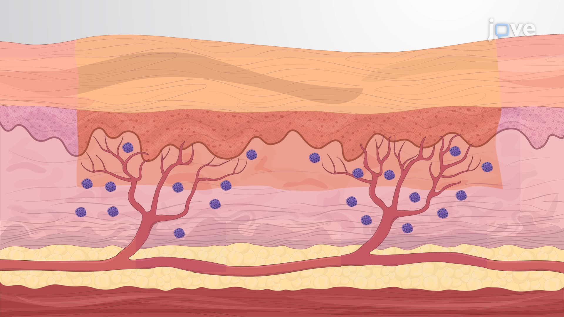 A Technique for Human Skin Grafting in a Mouse Model