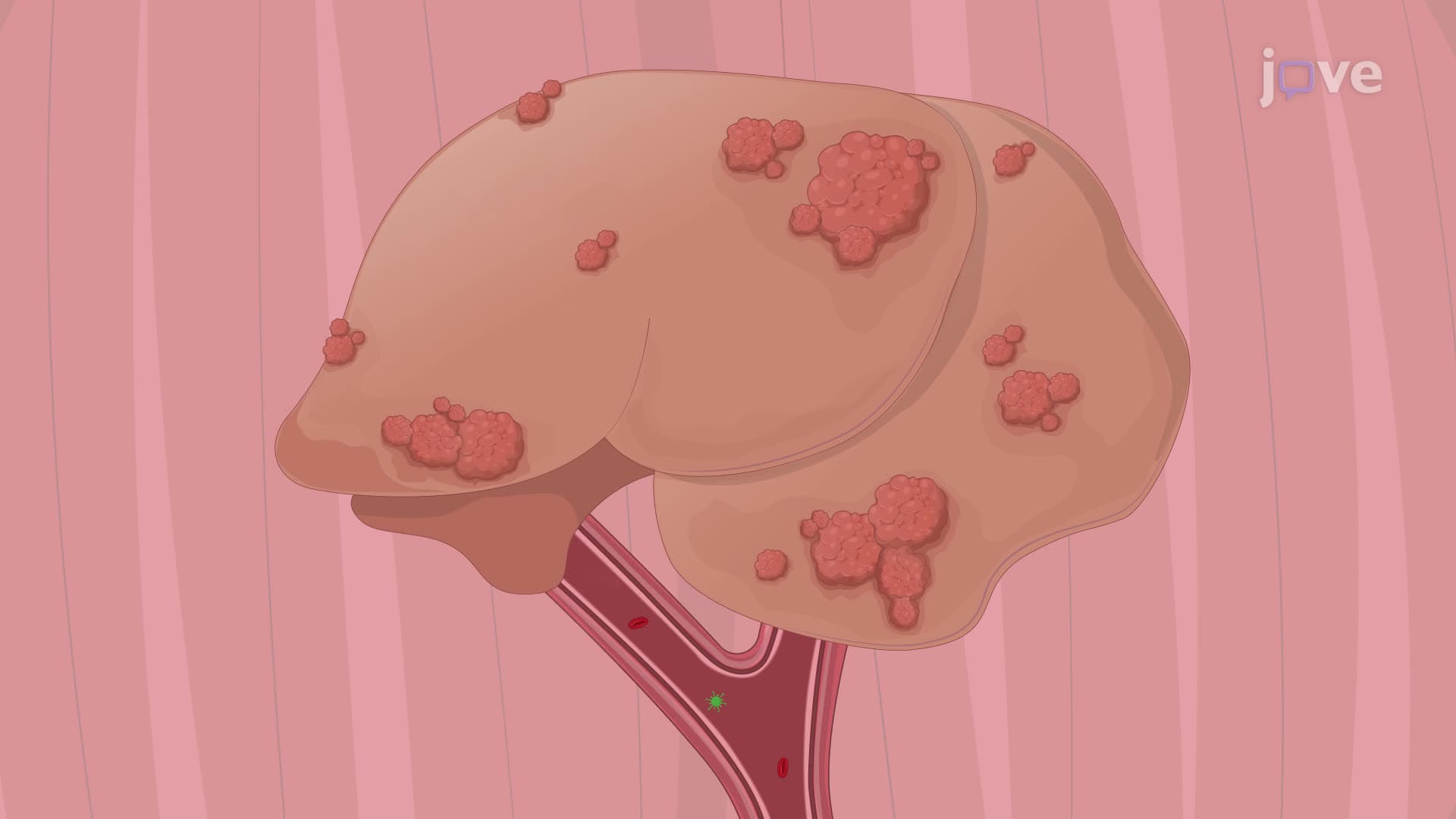 Targeting Liver Tumors with Oncolytic Viruses via the Hepatic Artery