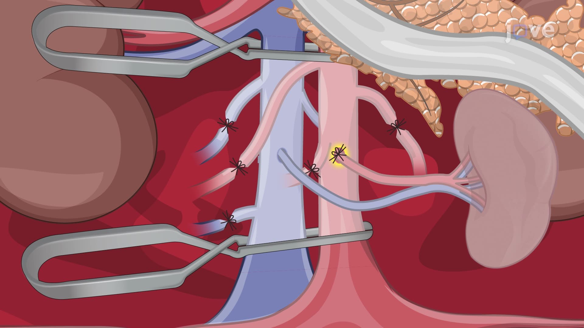 A Mouse Model of Vascularized Heterotopic Spleen Transplantation