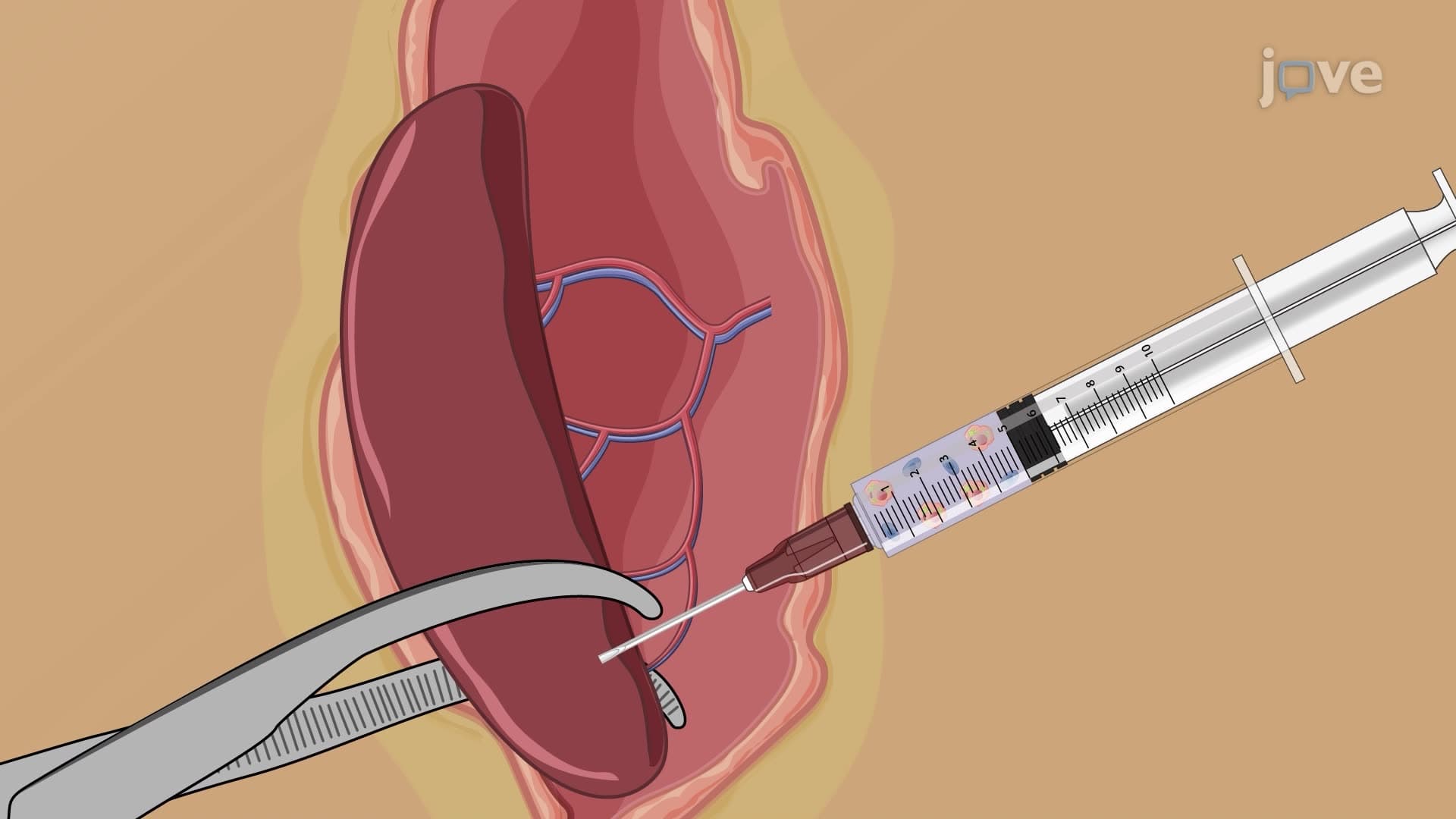 Developing a Humanized Mouse Model with Human Liver Cells and Immune Cells
