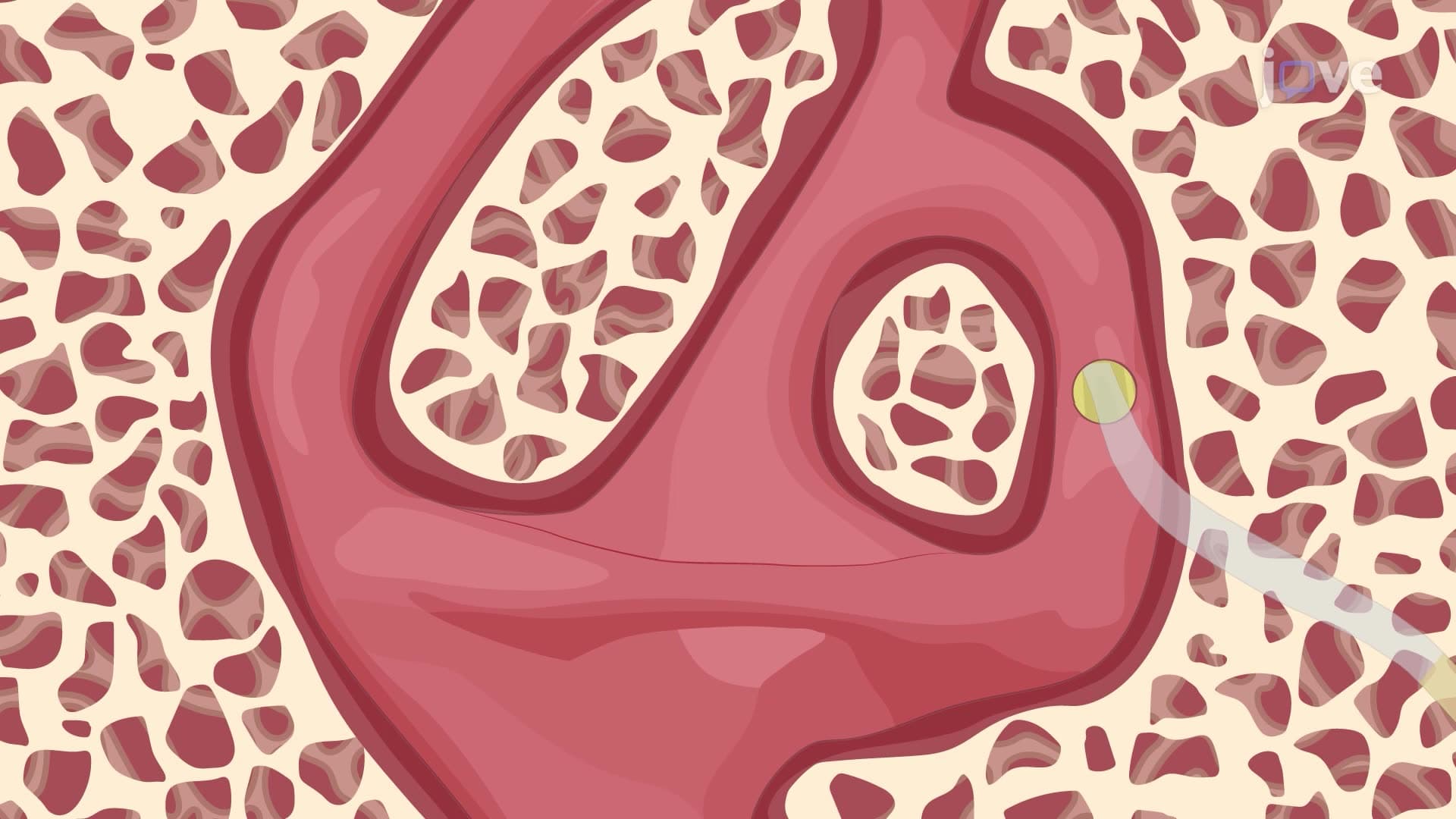 Canalostomy for Local Drug Delivery into the Inner Ear of an Adult Mouse