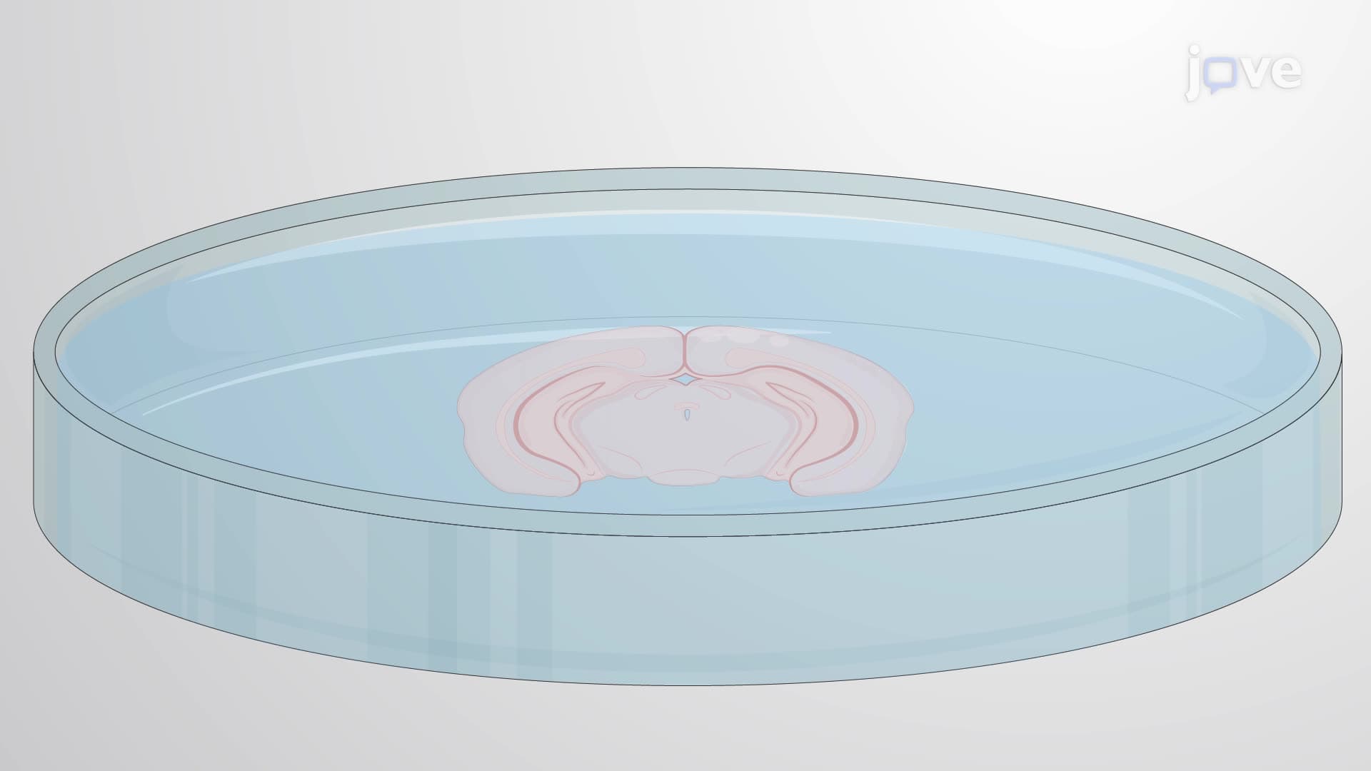 Isolation and Culturing of Adult Neural Stem Cells from the Mouse Subcallosal Zone