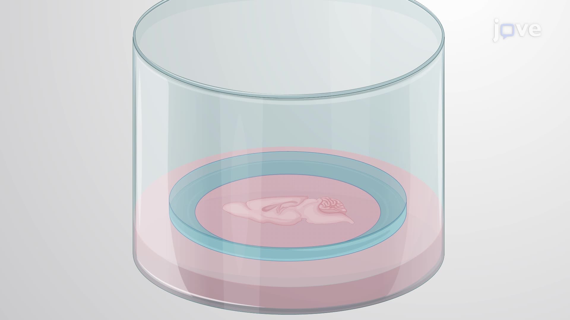 Establishing a Brain Tumor in an Organotypic Slice Co-culture Model