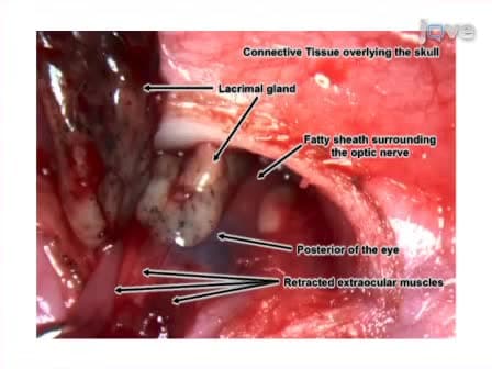 Optic Nerve Transection: A Model of Adult Neuron Apoptosis in the Central Nervous System