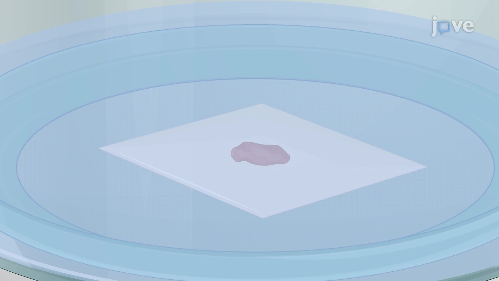 Generating and Maintaining Slice Cultures from Human Glioblastoma Tissue