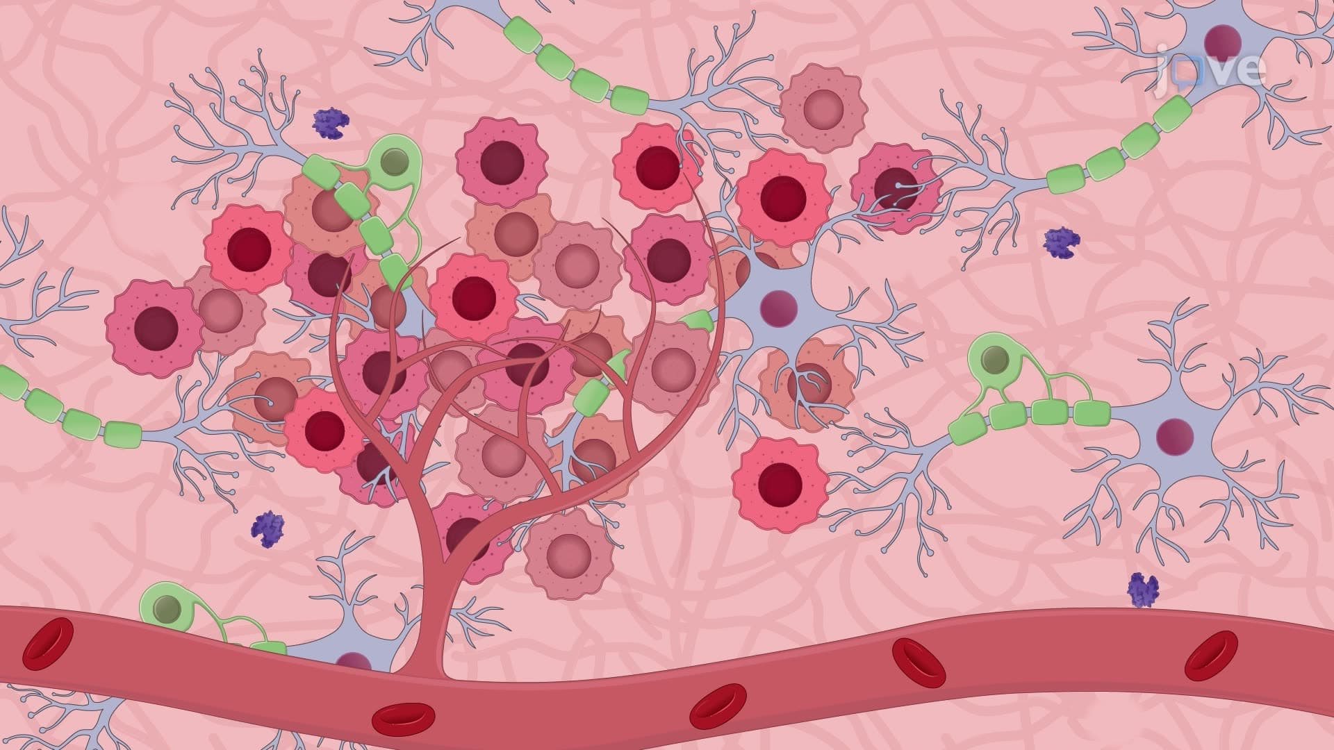 Isolating and Culturing Cells from Diffuse Intrinsic Pontine Glioma