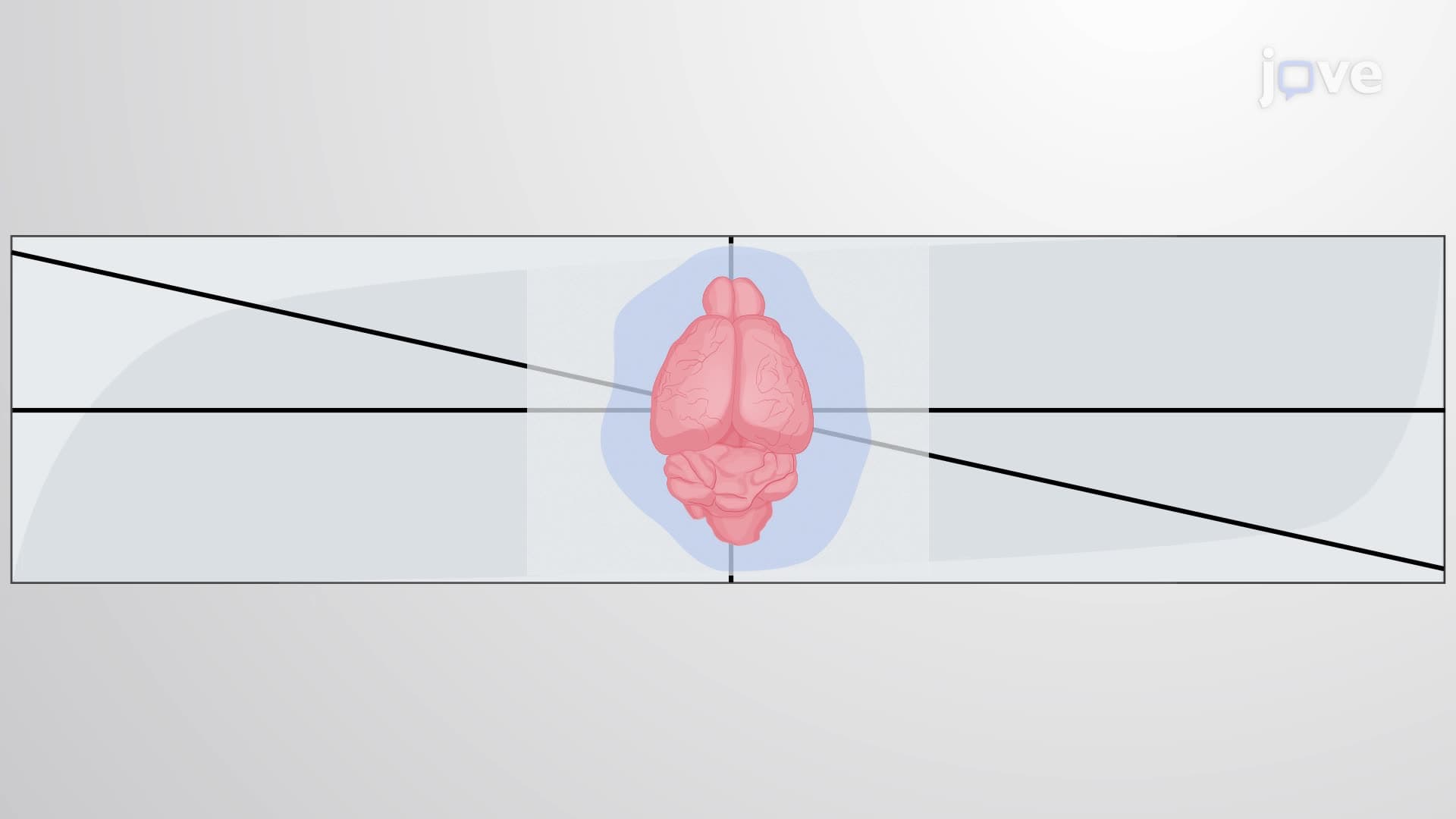 Preparation of Colliculo-Thalamocortical Slices from a Mouse Pup Brain