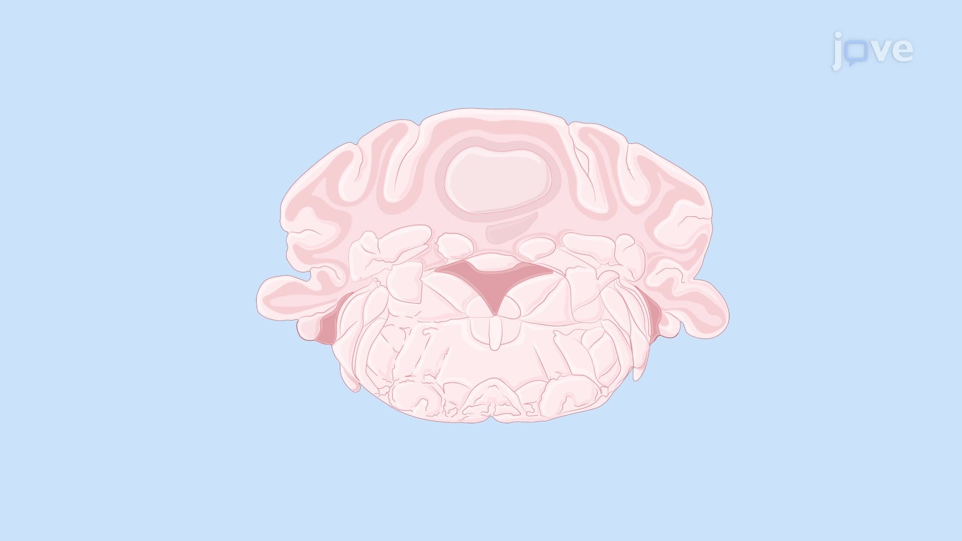 Applying Noise Currents to Medial Vestibular Nucleus Neurons Using Whole-Cell Patch-Clamp Technique