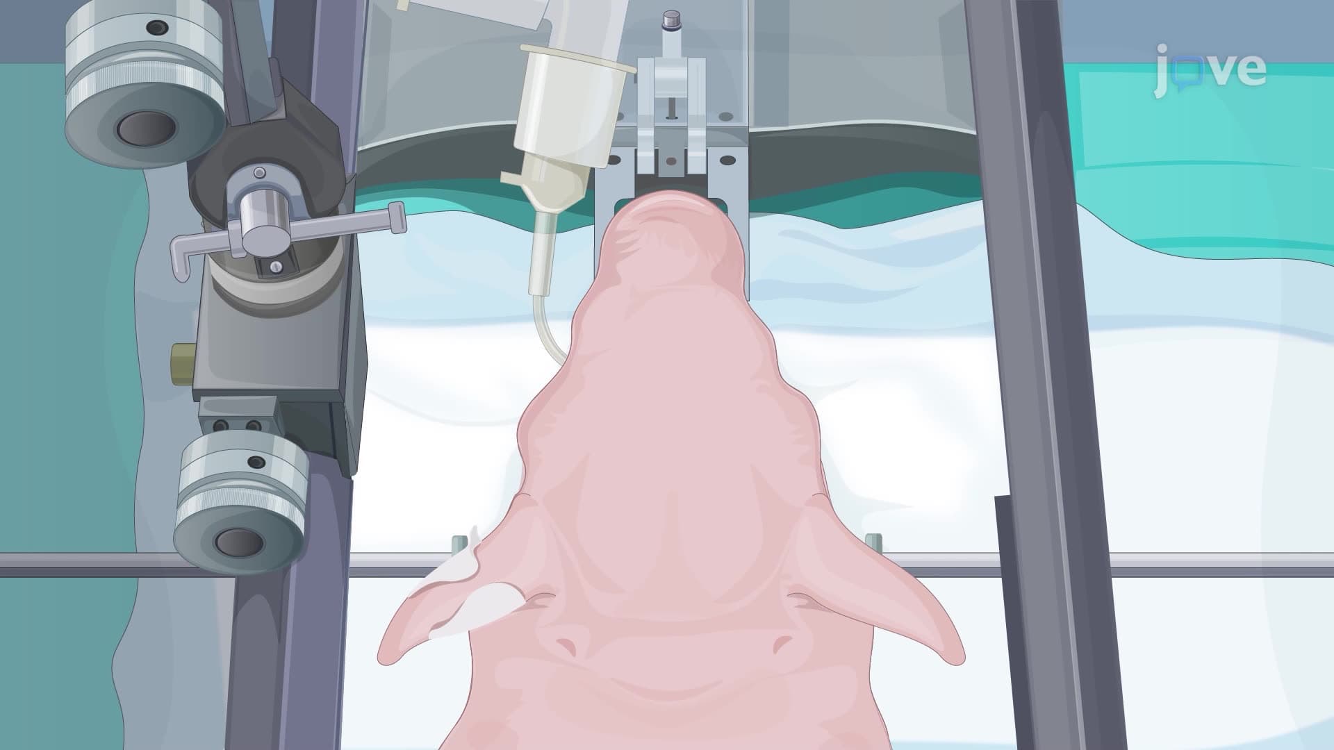 Measuring Brain Glutamate Levels Under Anesthesia in Neonatal Piglets Using a Microelectrode Array