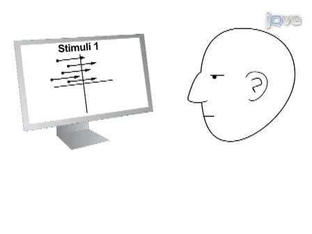 State-Dependency Effects on TMS: A Look at Motive Phosphene Behavior