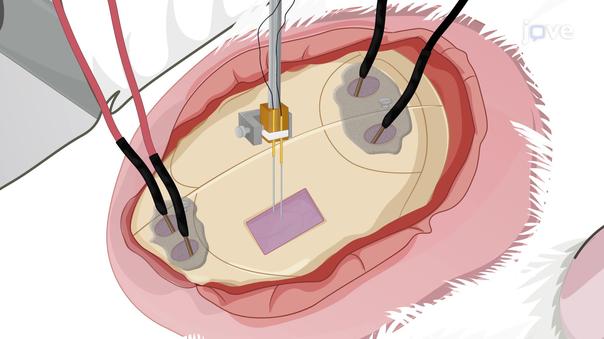 In Vivo Electrophysiological Recordings of Brain Activities from Multiple Sites in Rats