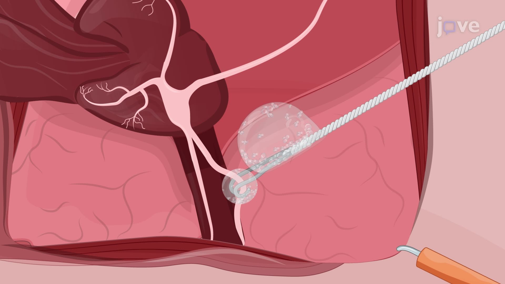 Performing Cavernous Nerve Stimulation in Rats to Measure Intracavernous Pressure