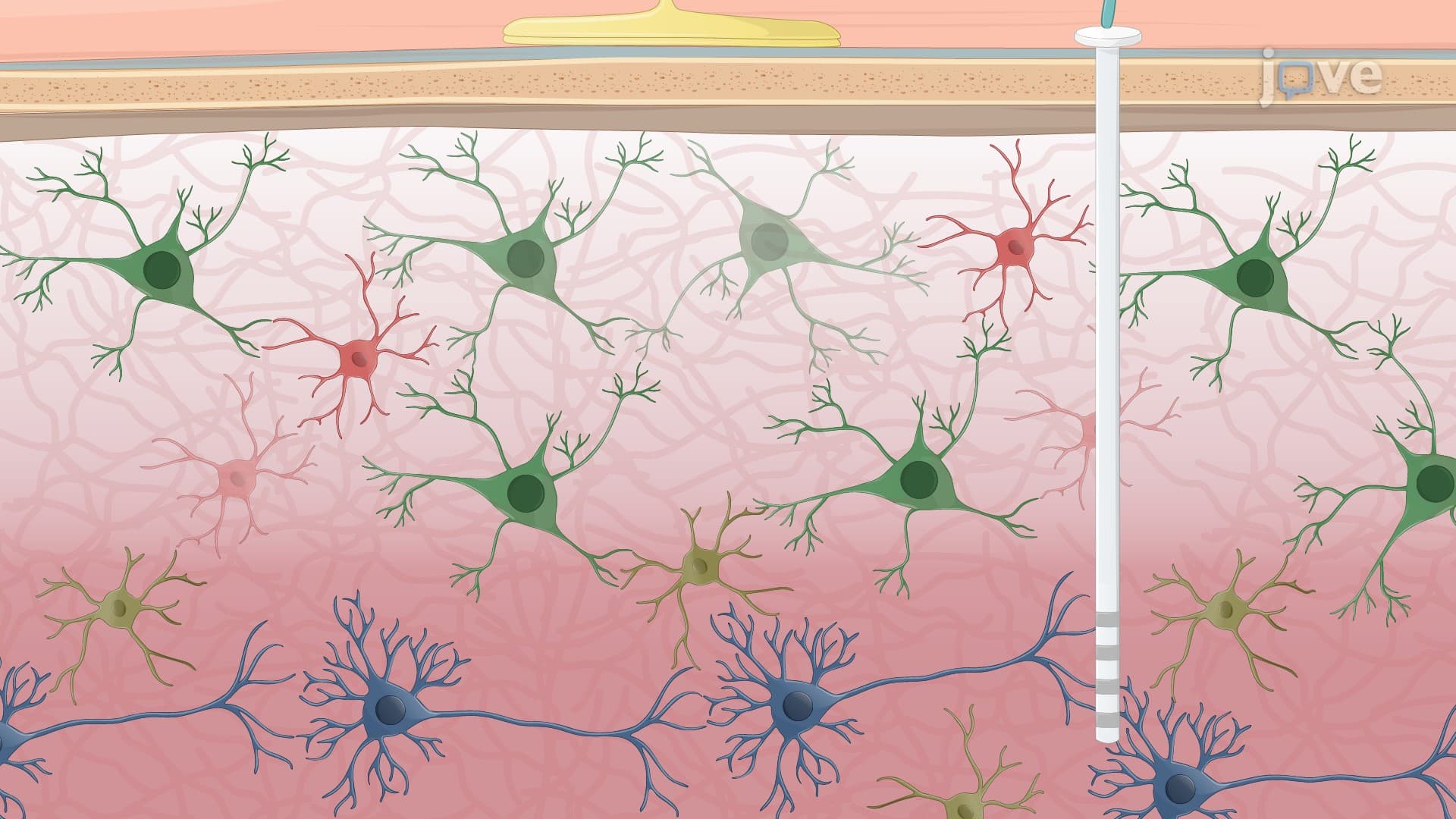 Recording Cortical and Subcortical Neuronal Activity Using Electrode Systems