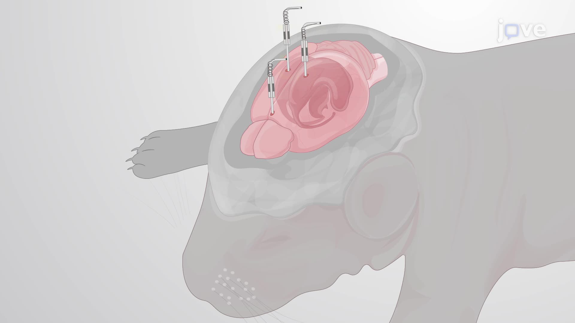 Recording of Induced Seizures through Electroencephalography in Freely Moving Rat Pups
