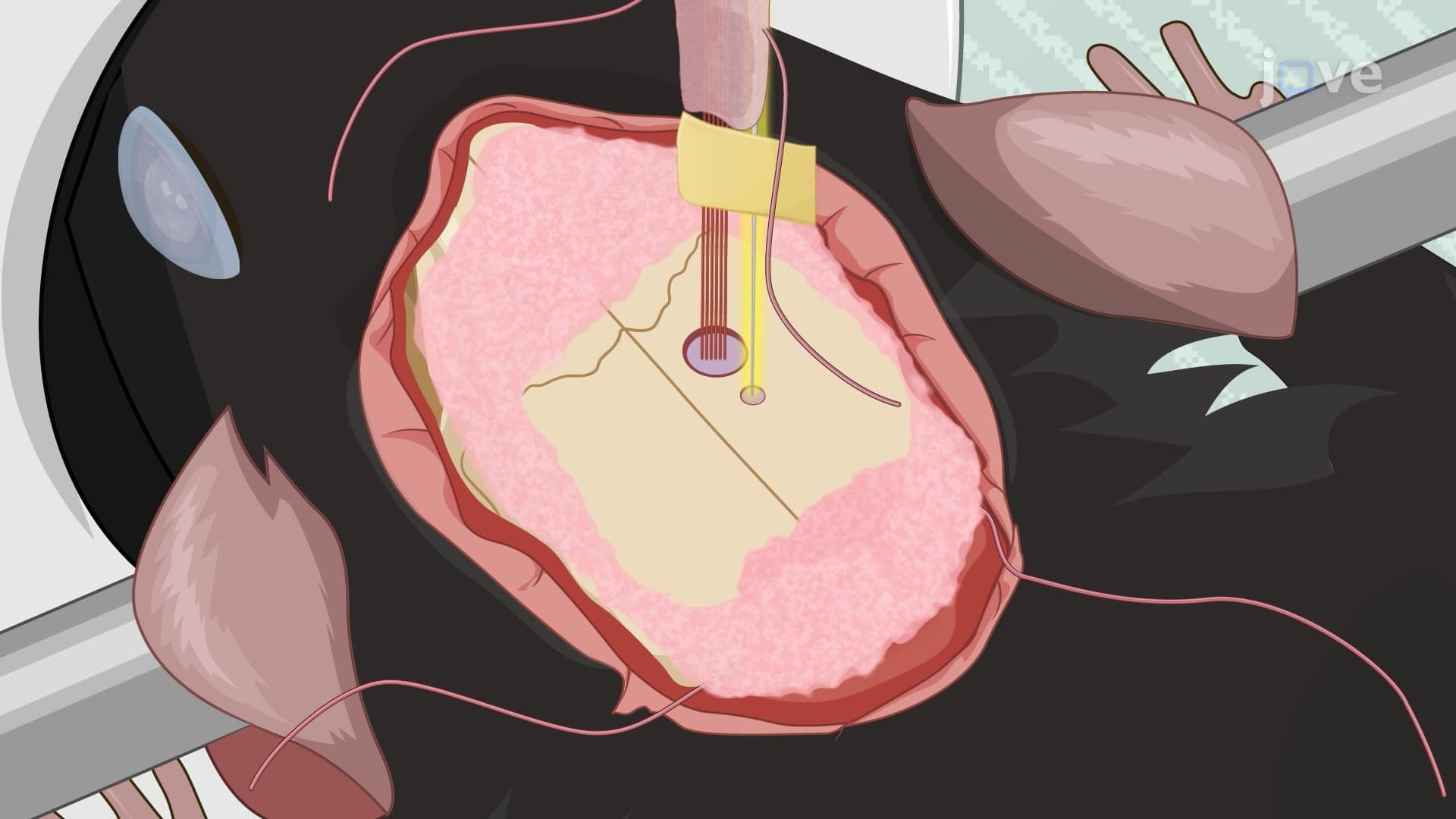 Implanting an Electrode Array and Optic Fiber into the Mouse Hippocampus