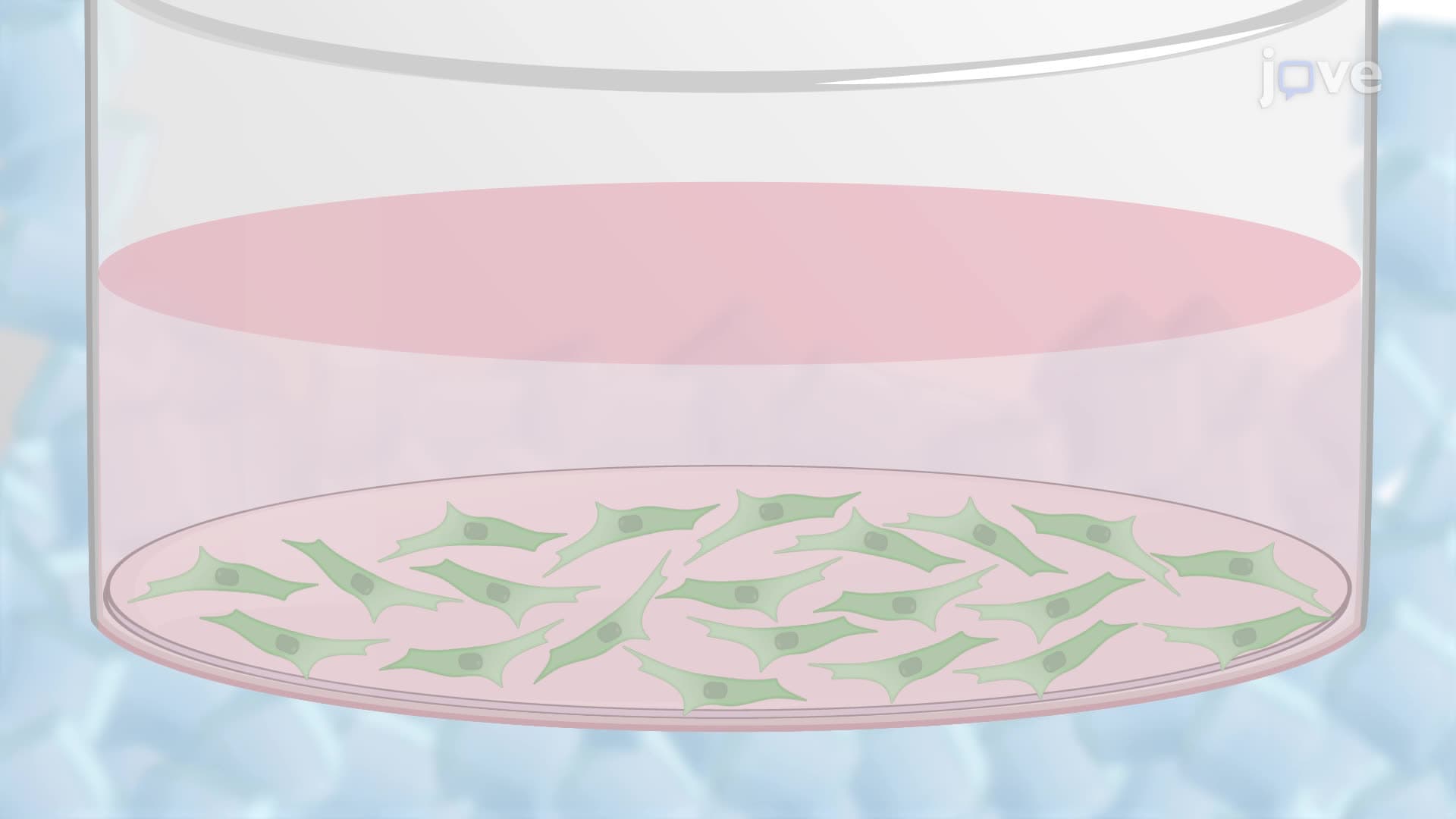 Protein Extraction from Neuronal Cells