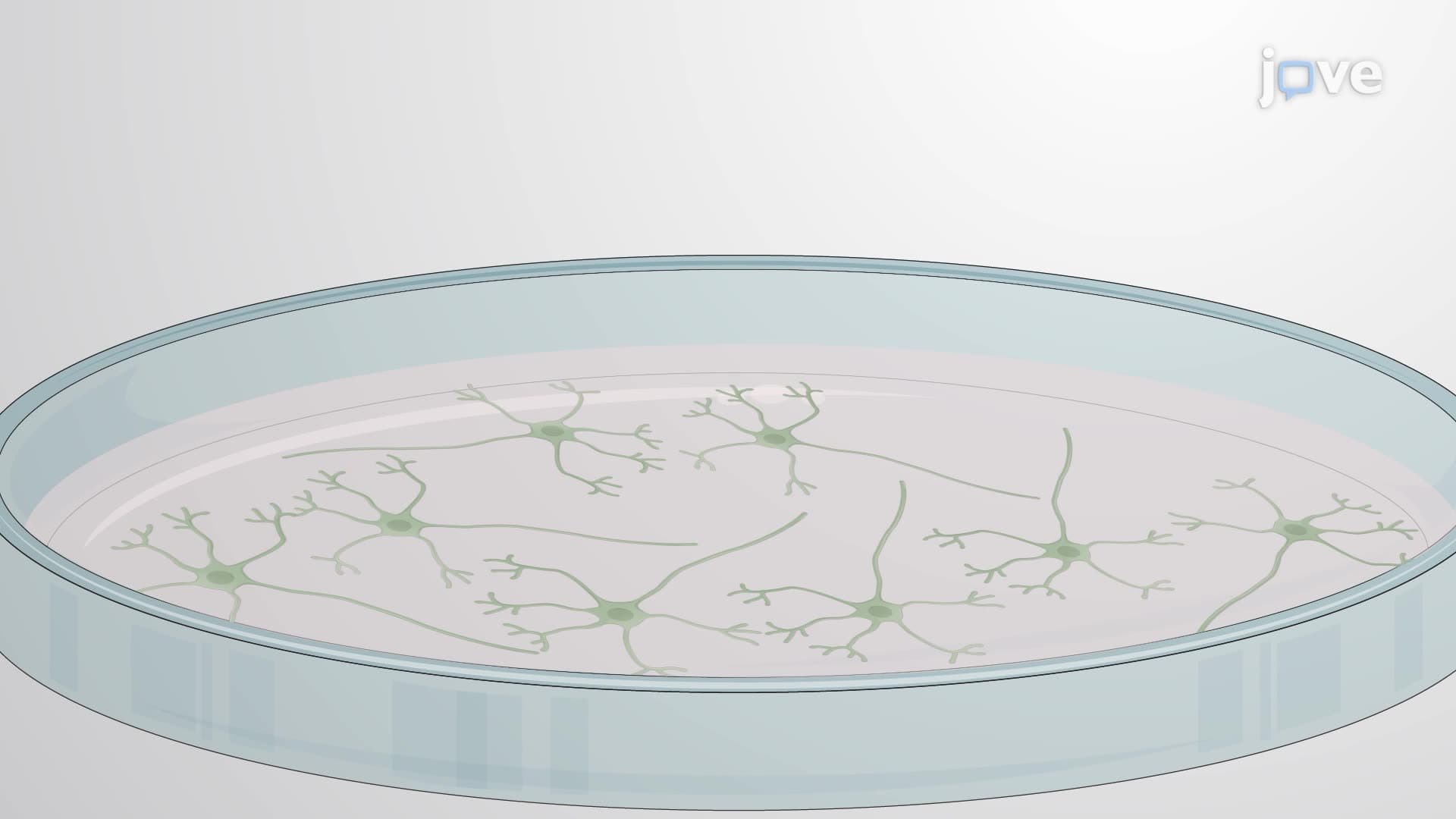 Modeling Neuronal Injury in Mouse Primary Cerebellar Granule Neurons