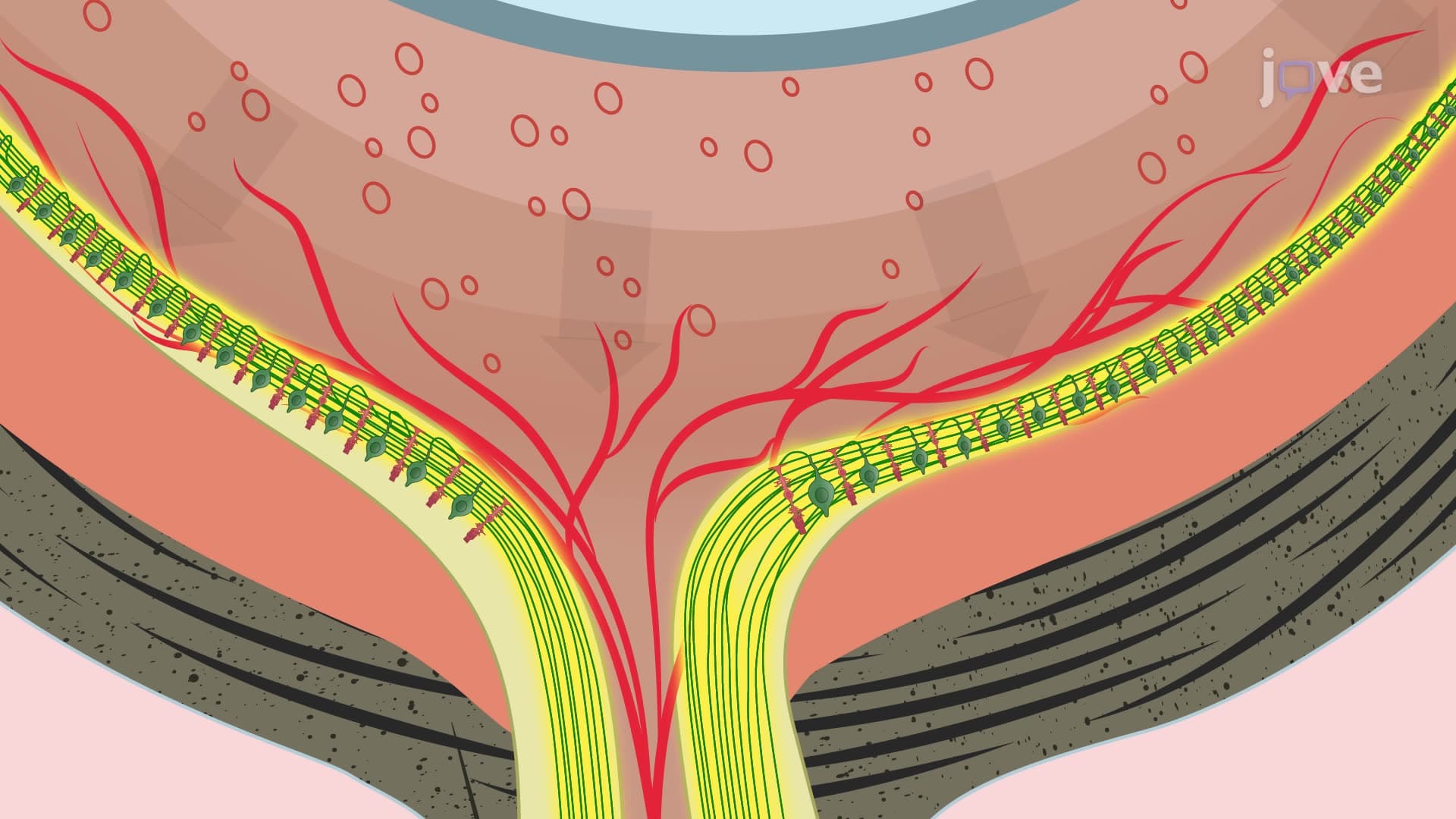 A Hypertonic Saline Injection Technique for Inducing Glaucoma in Rats