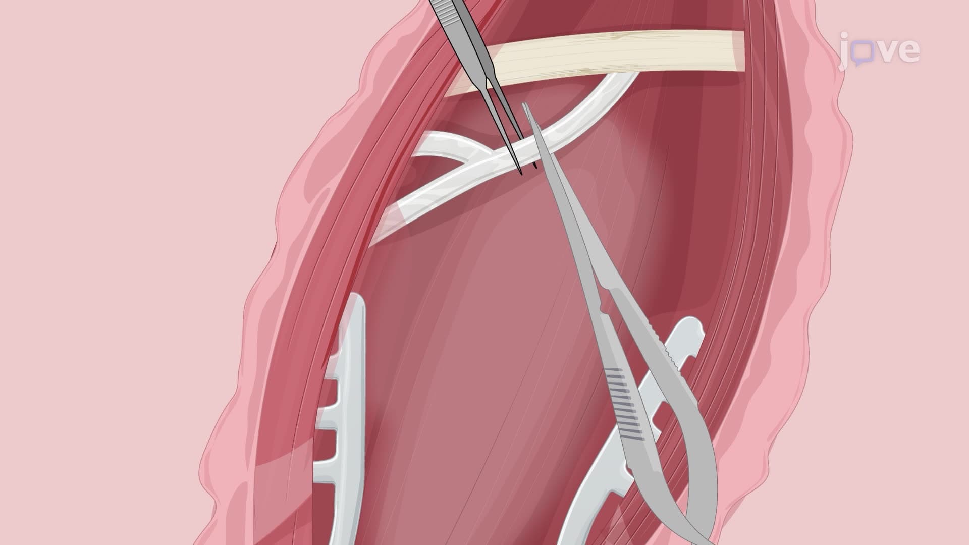 Inducing a Facial Nerve Injury in a Rat Model