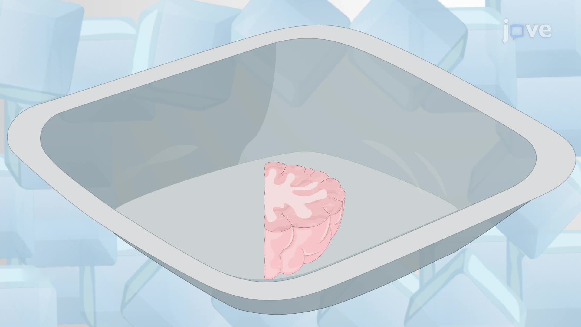Isolation of Detergent-Insoluble Protein Aggregates From Human Postmortem Brain Tissue