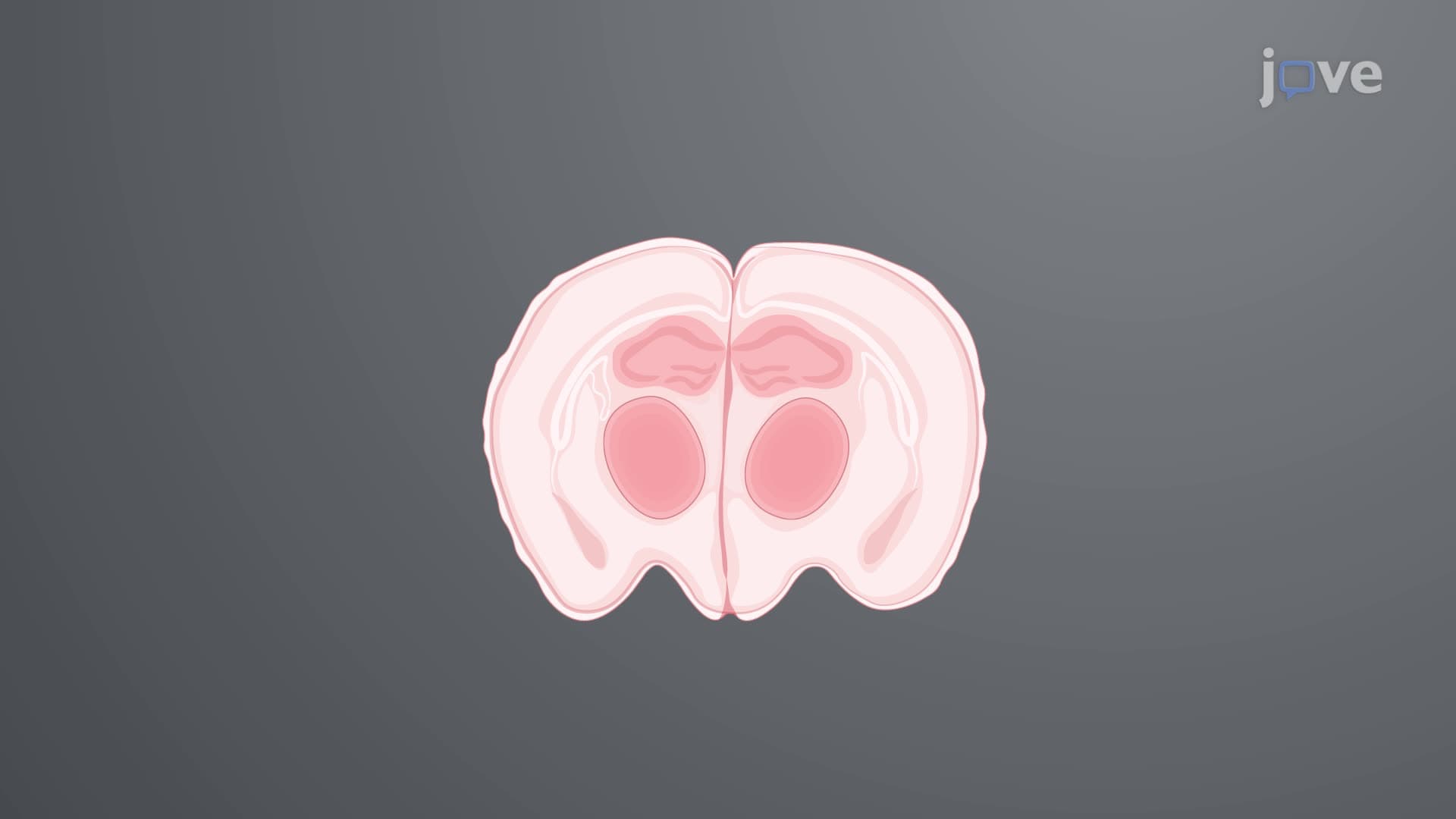 Treatment of Rat Coronal Slices with a Neurotoxic Peptide