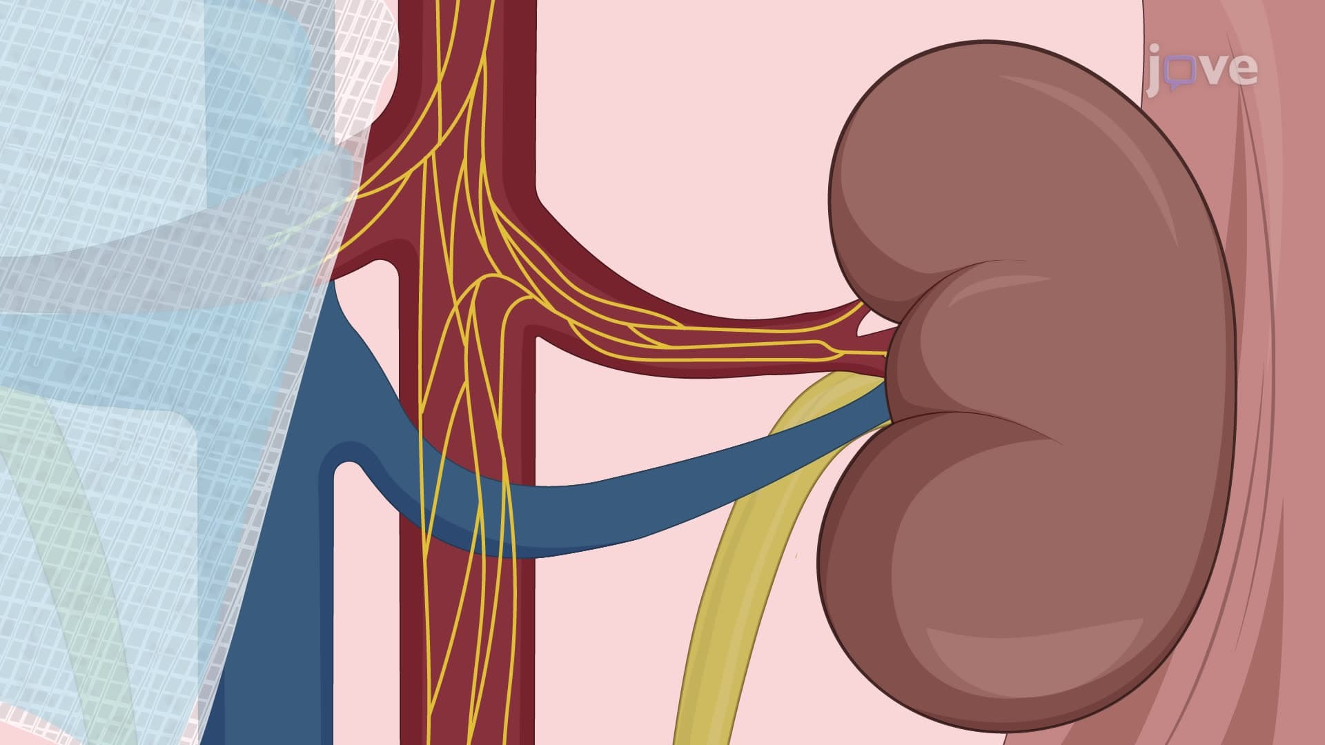 Sympathetic Denervation of Renal Arteries in an Angiotensin II-Induced Hypertension Mouse Model