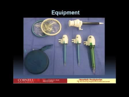 Single Port Donor Nephrectomy