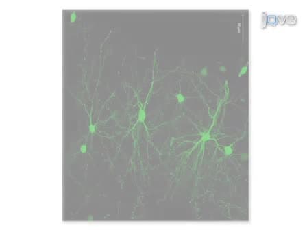 Whole Cell Recording from an Organotypic Slice Preparation of Neocortex